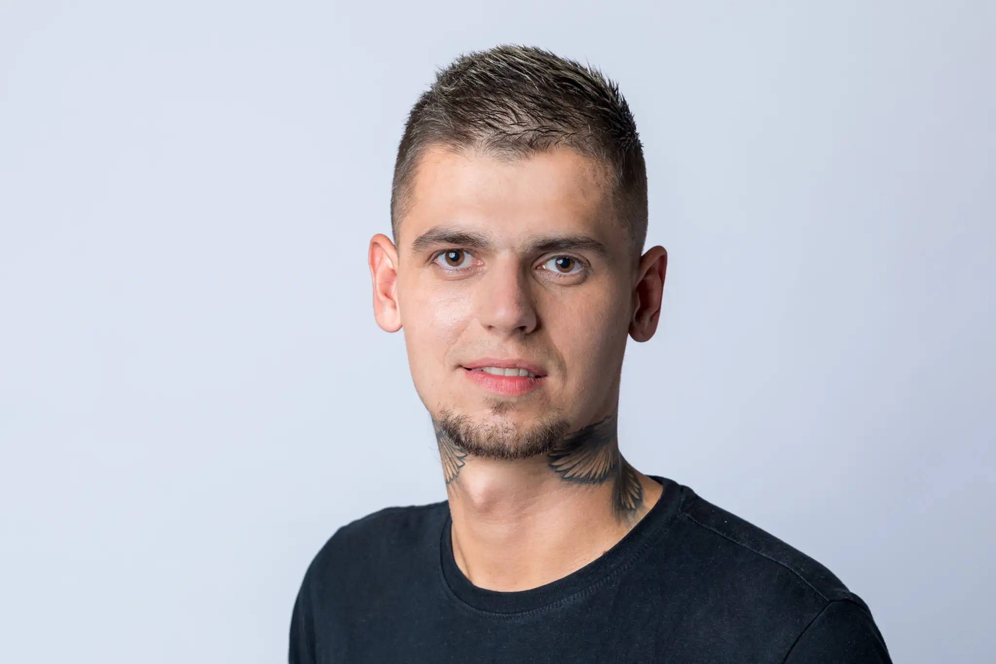 Dievčatko sa narodilo so štyrmi nohami a tromi rukami.