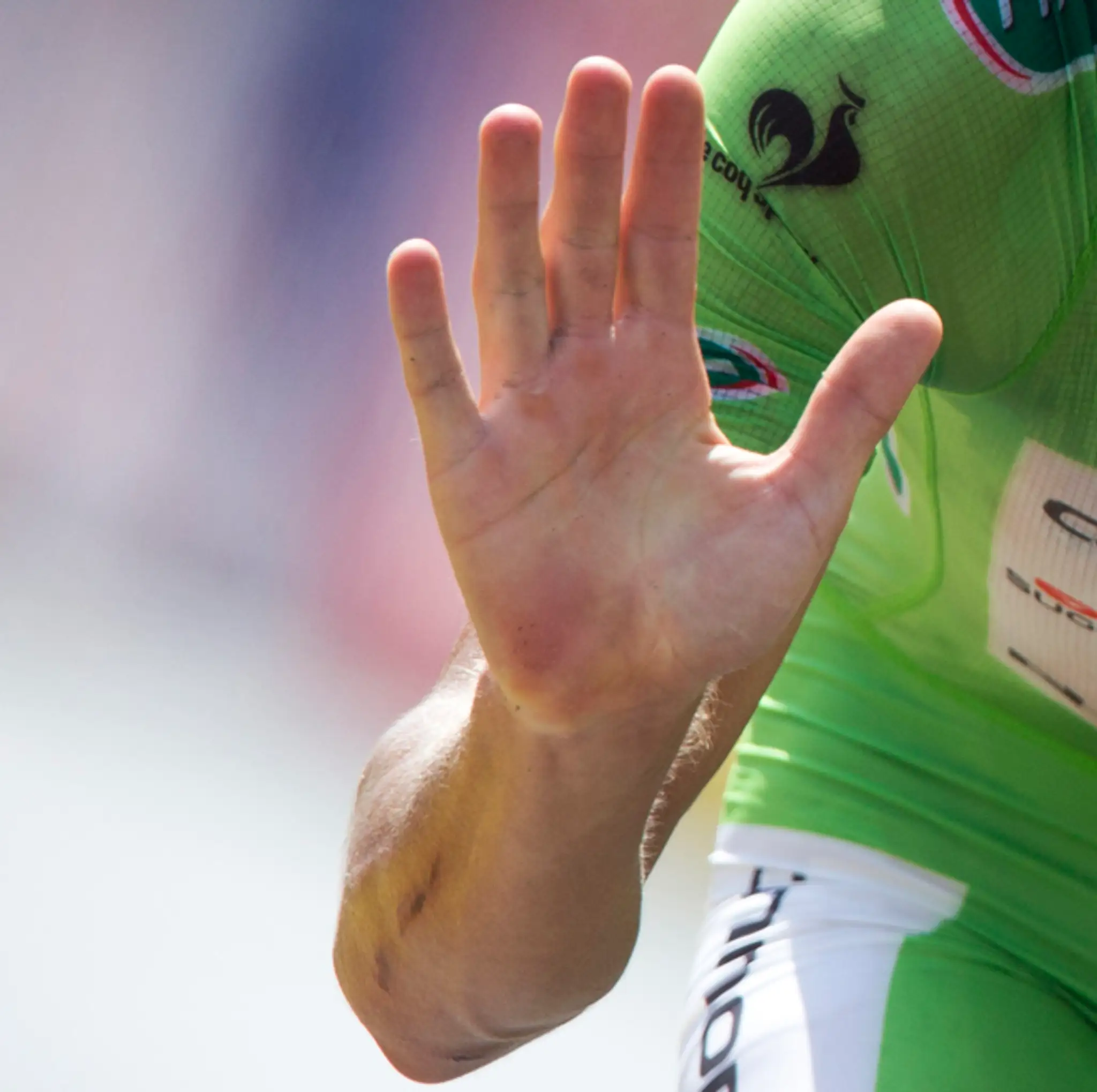 Saganova ruka po TdF.