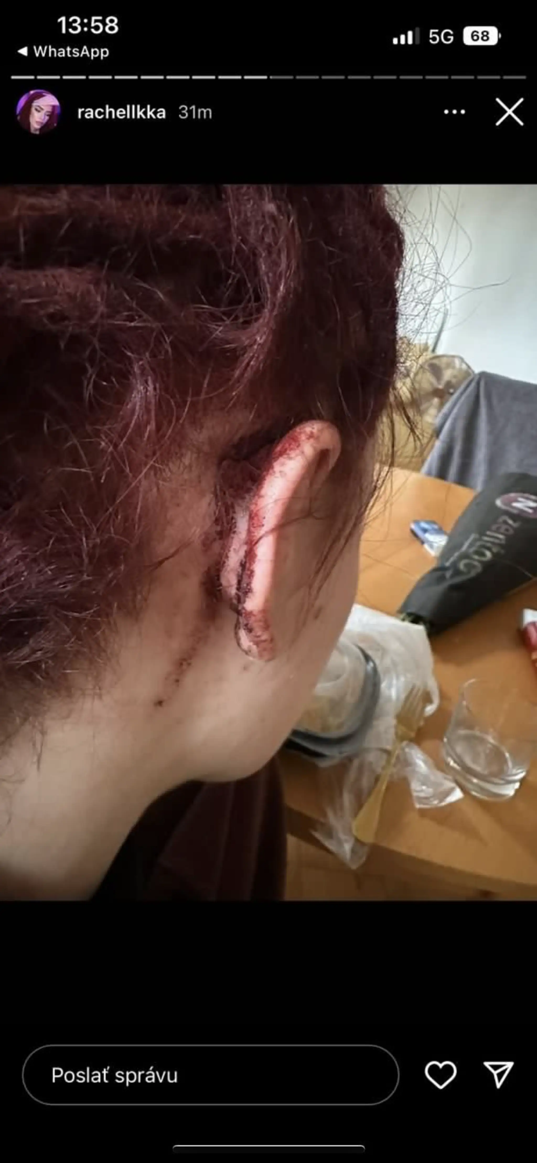 Týranie influencerky