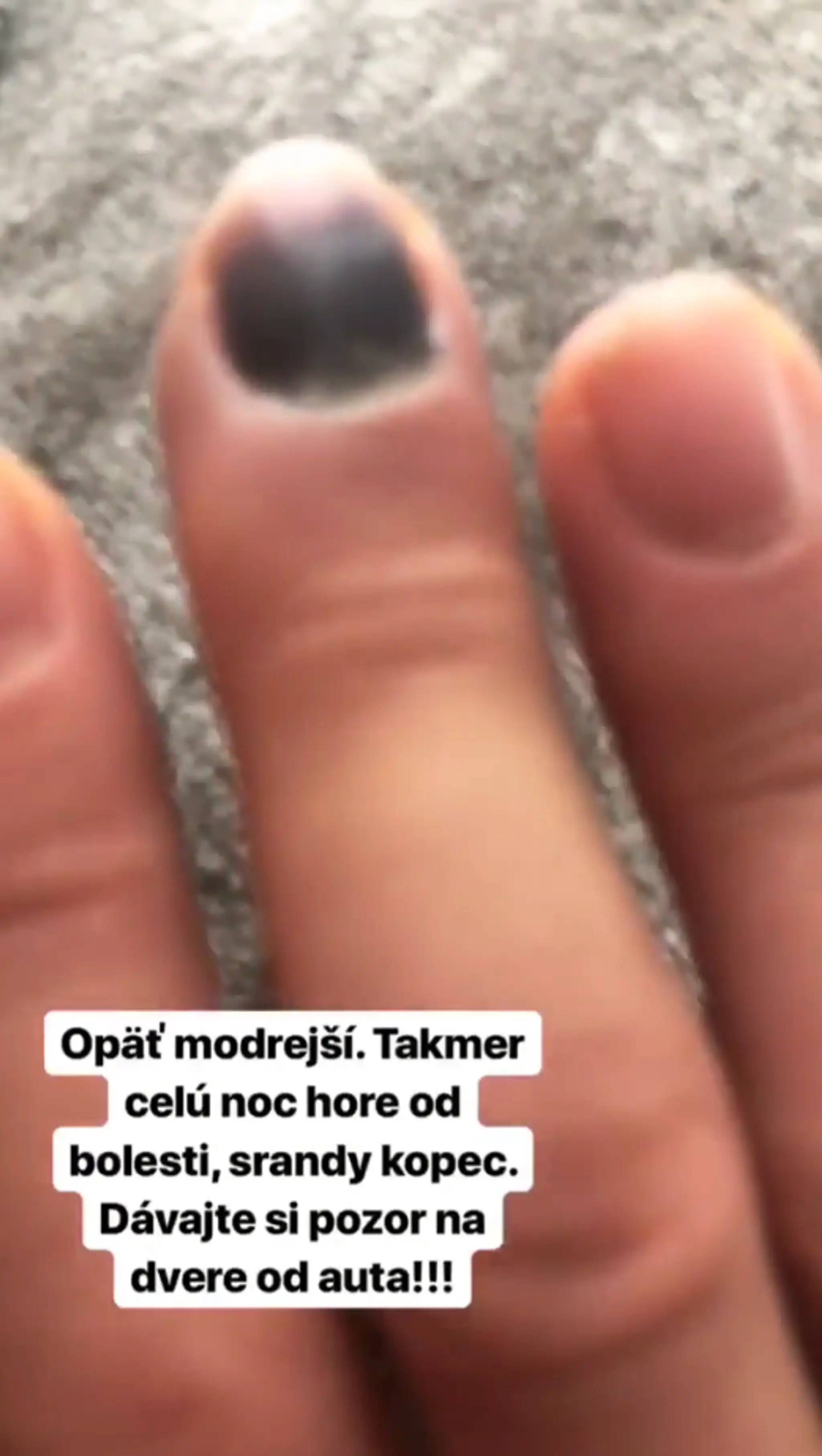 Katka Knechtová s mačičkou Amáliou