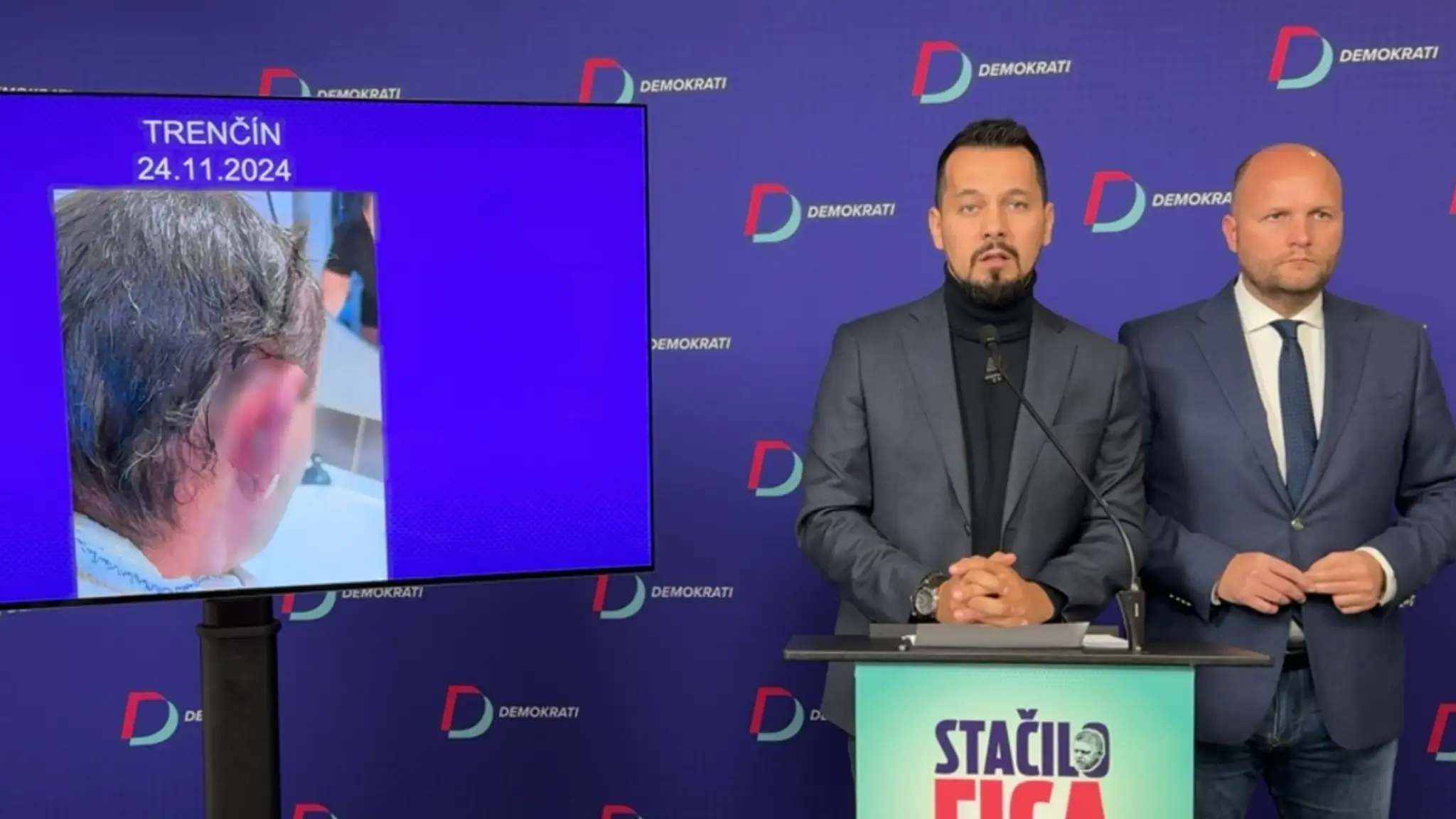 Demokrati upozornili na dva tvrdé policajné zásahy