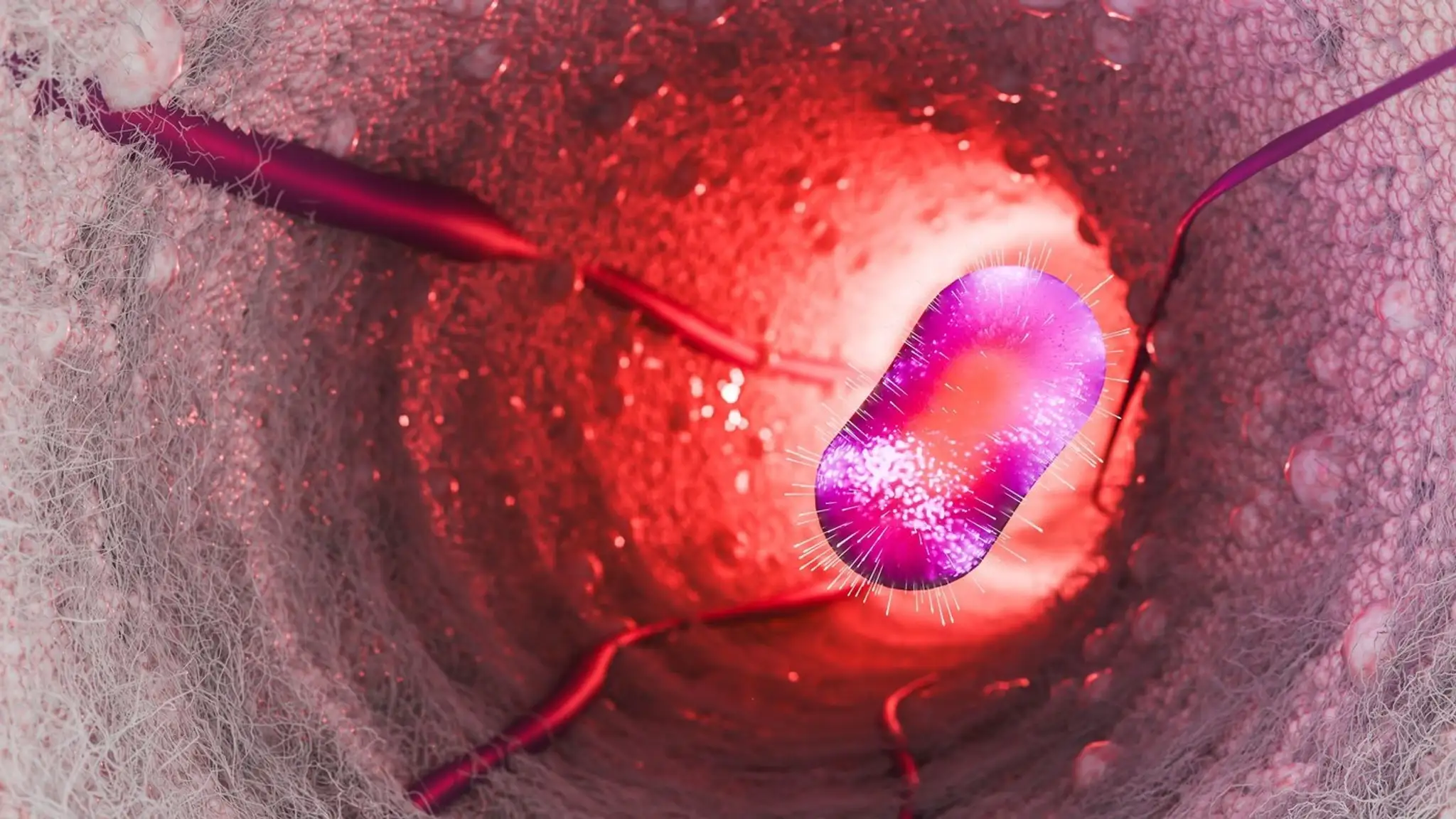 Mpox vírus