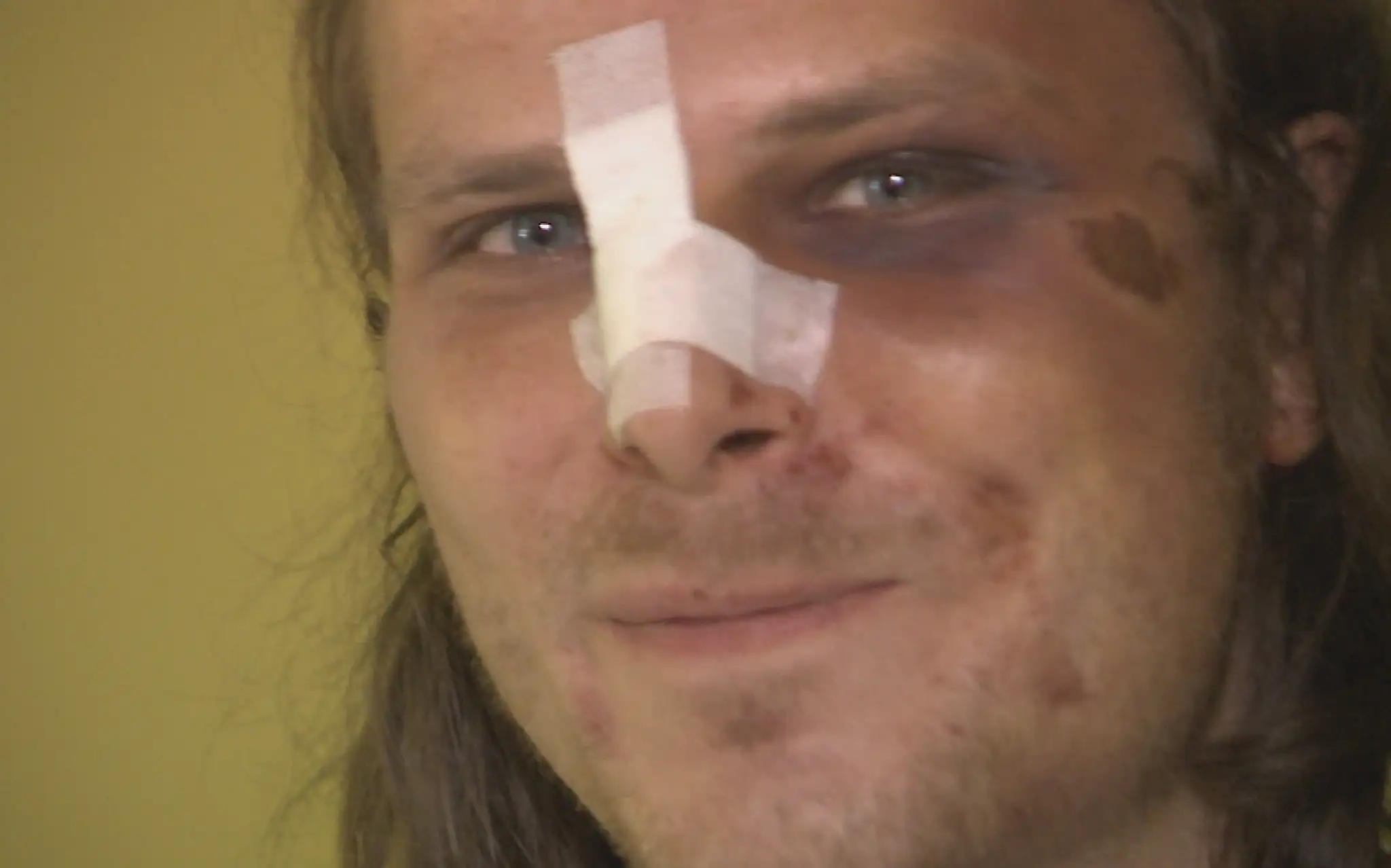 Štefan po zásahu policajtov