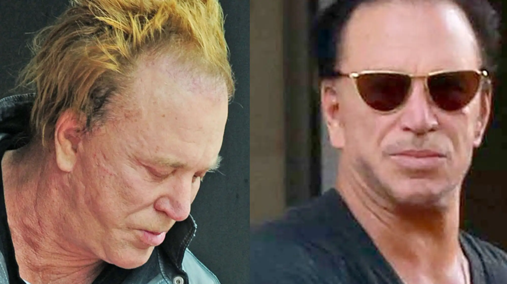 Mickey Rourke