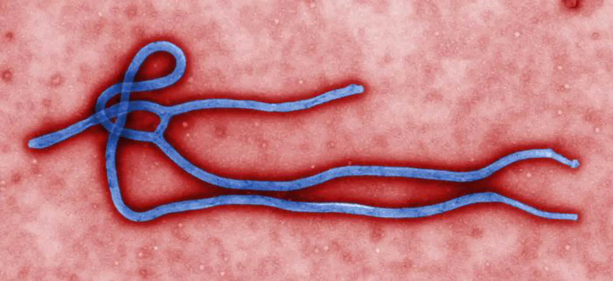 Vírus ebola