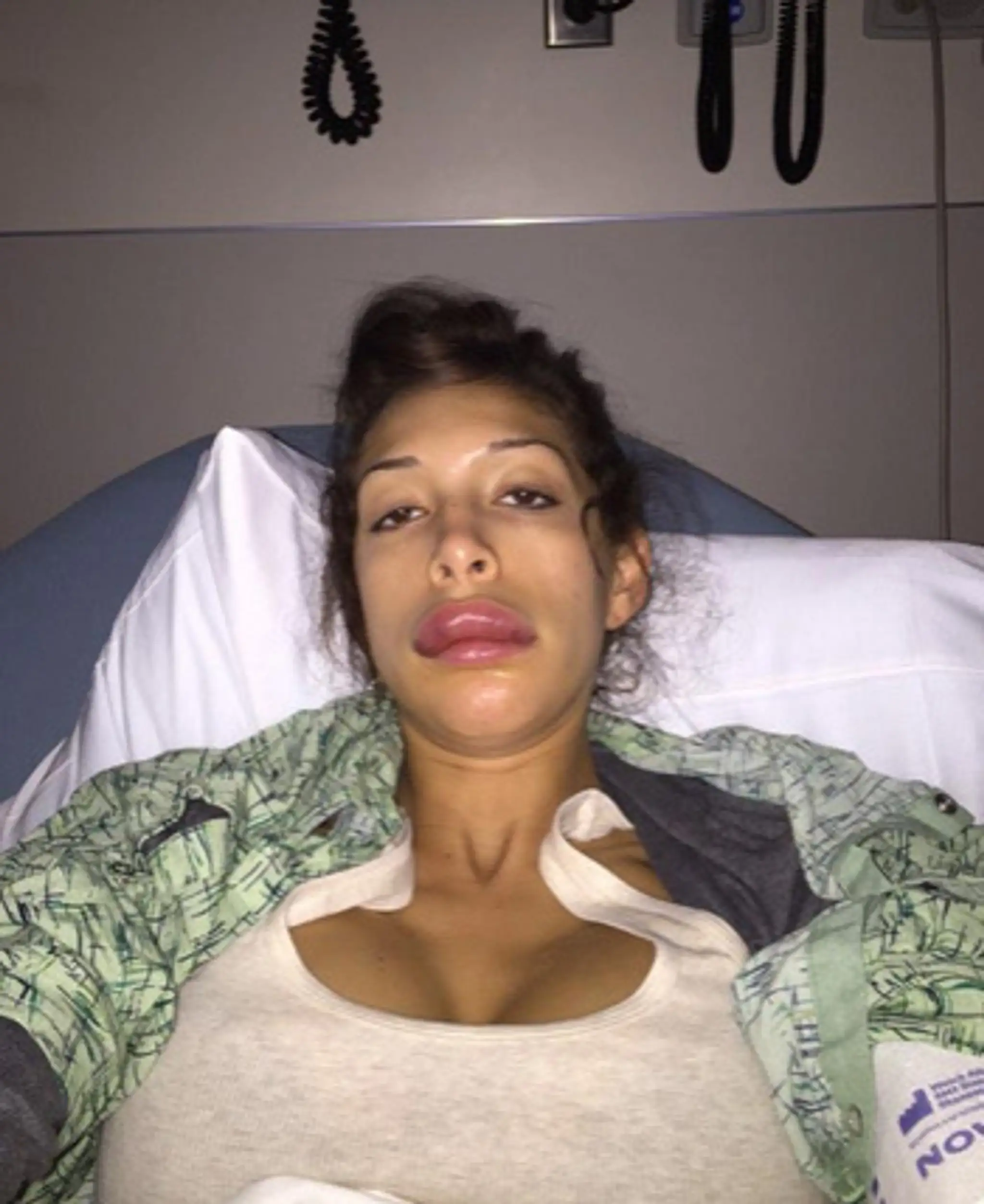 farrah lips1.jpg