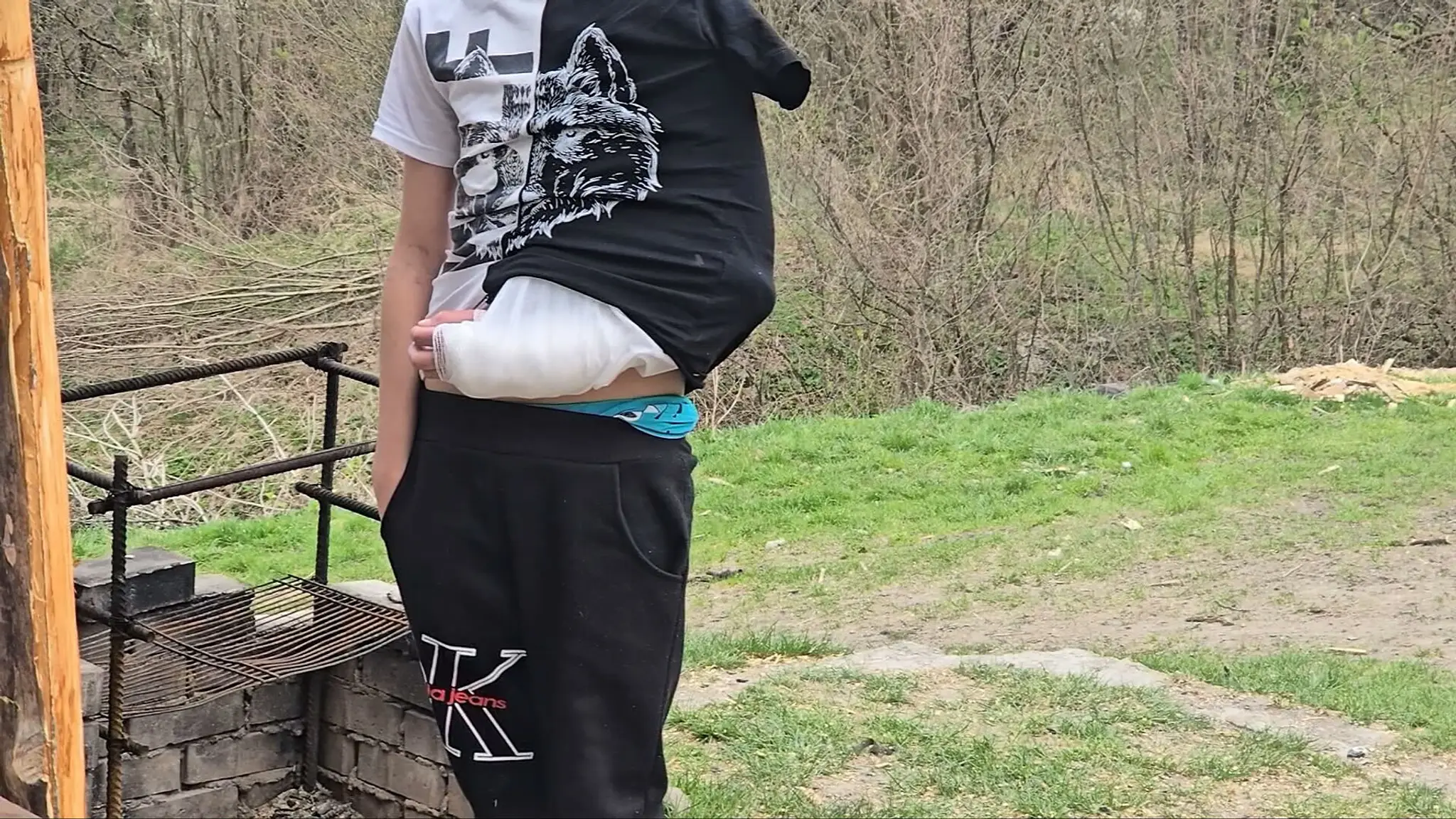 Konflikt žiakov na Gemeri sa skončil zlomenou rukou