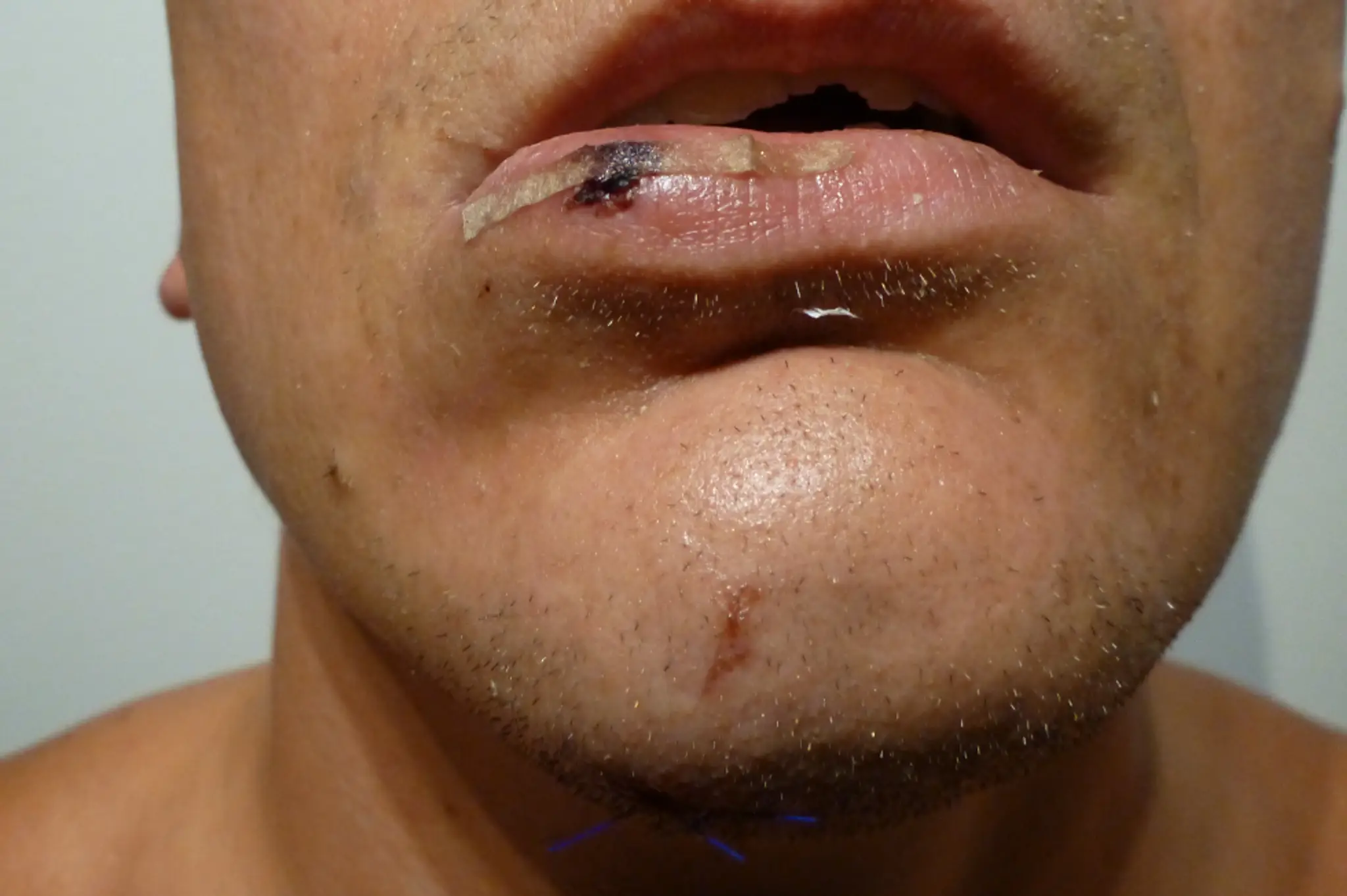 Policajná brutalita