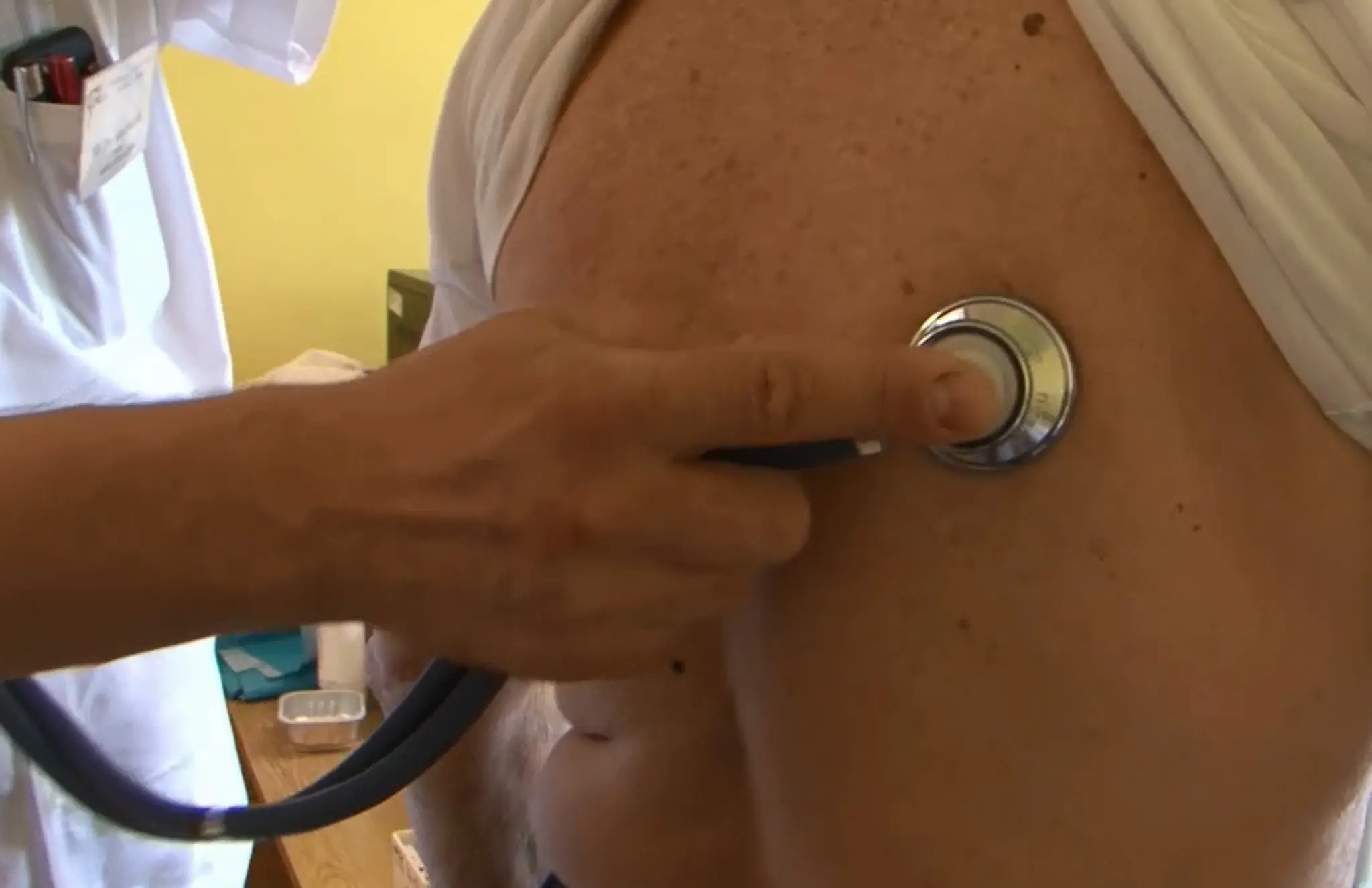 V Prievidzi bojujú s vysoko nákazlivou chorobou. Začala sa šíriť medzi bezdomovcami 
