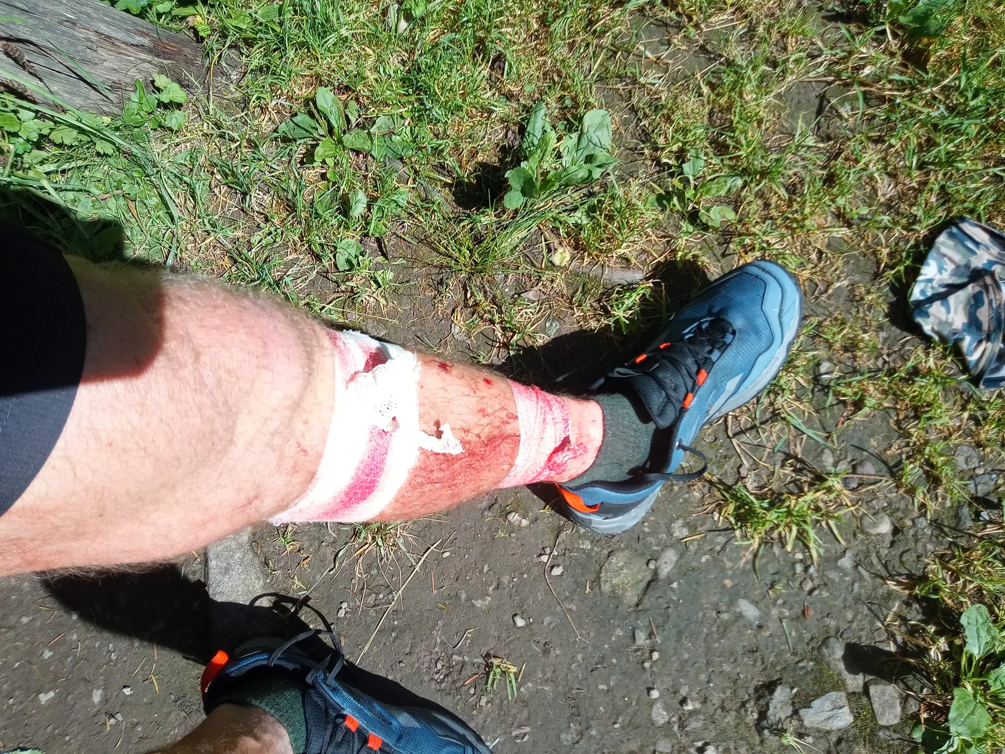 Petra počas letnej expedície napadla medvedica 