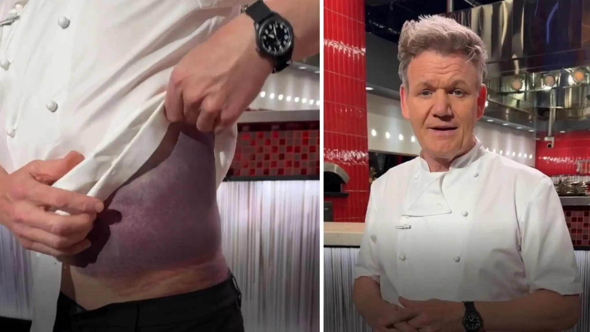 Svetoznámy šéfkuchár Gordon Ramsay mal nehodu. 