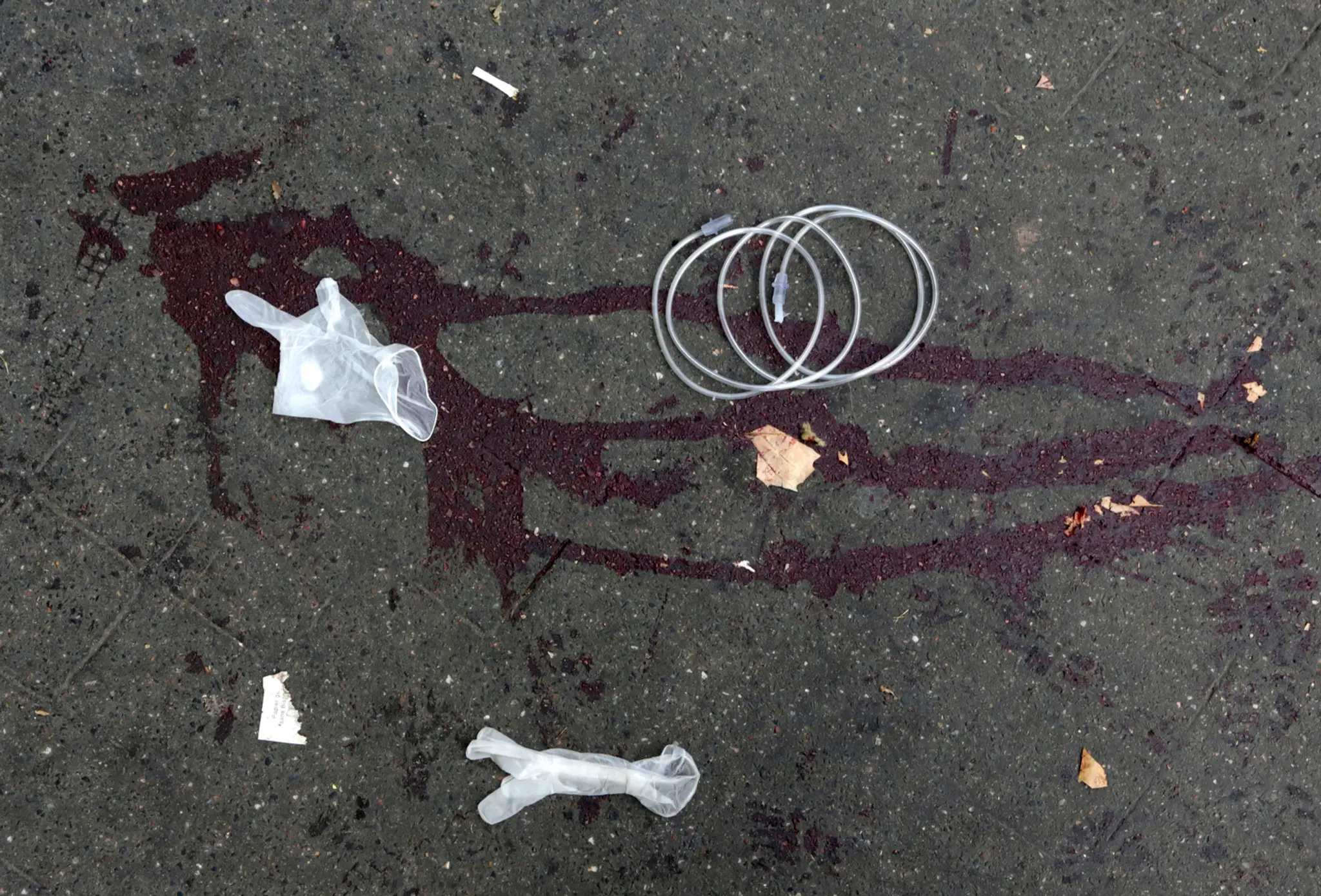 Stopy krvi pred koncertnou sieňou Bataclan v Paríži