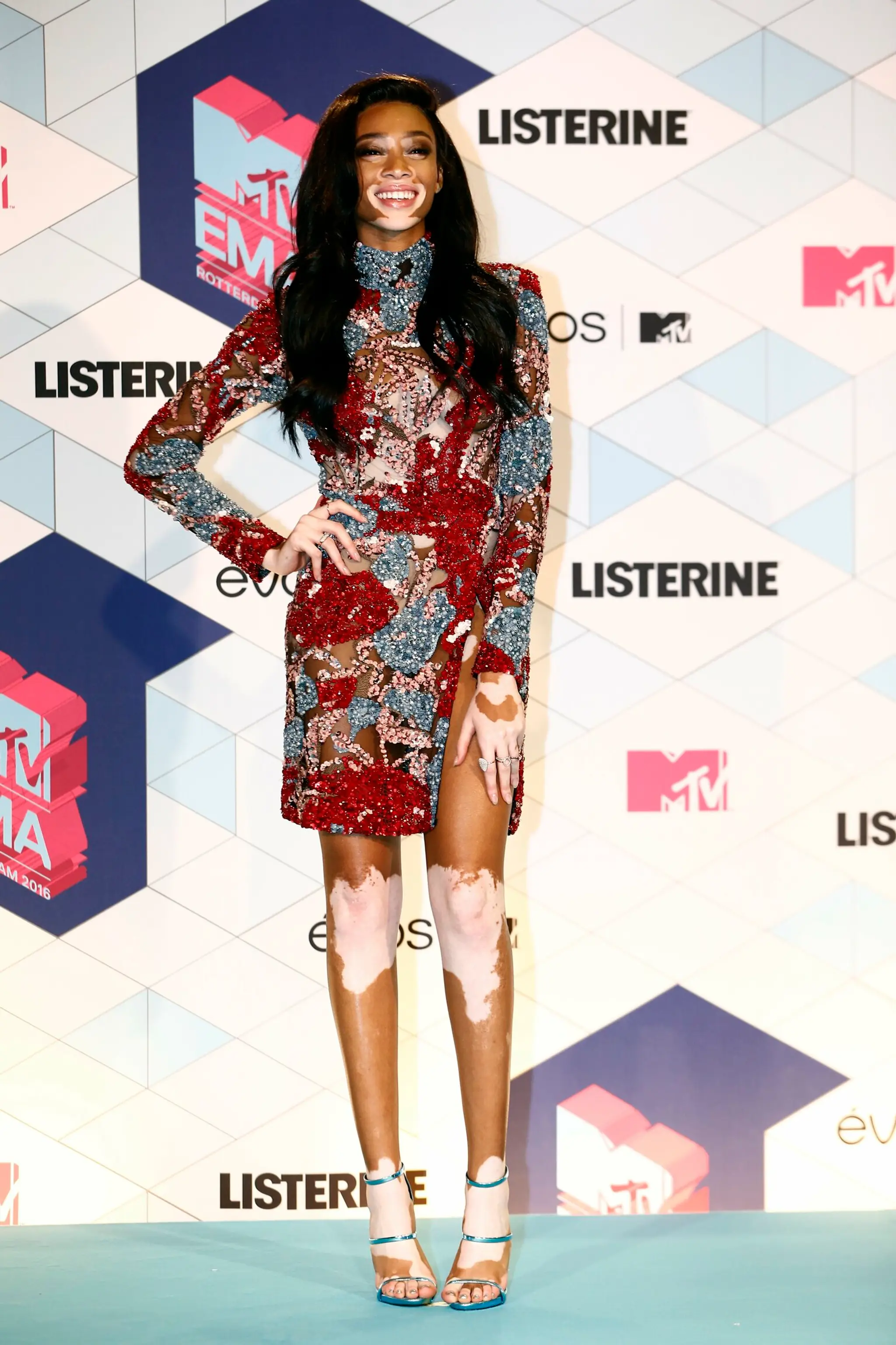 Winnie Harlow
