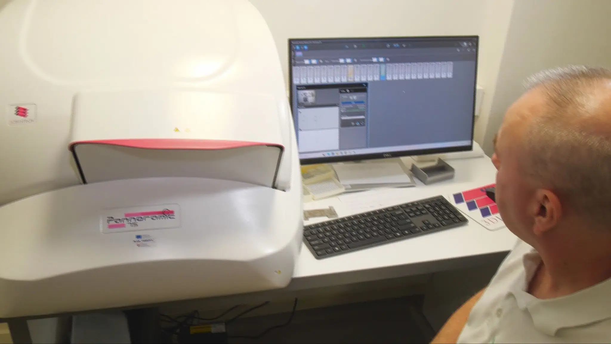Nová technológia na diagnostiku rakoviny