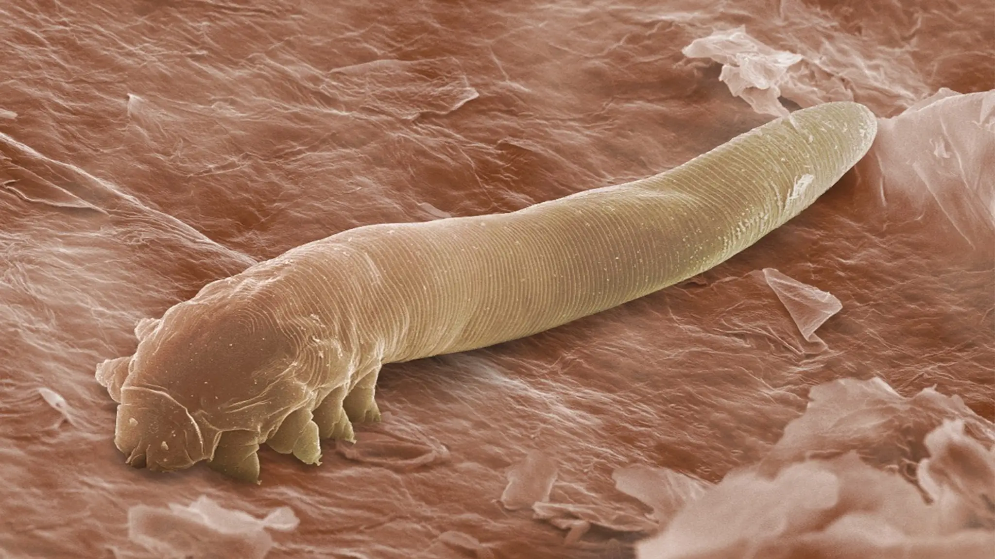 Mikroskopické roztoče Demodex