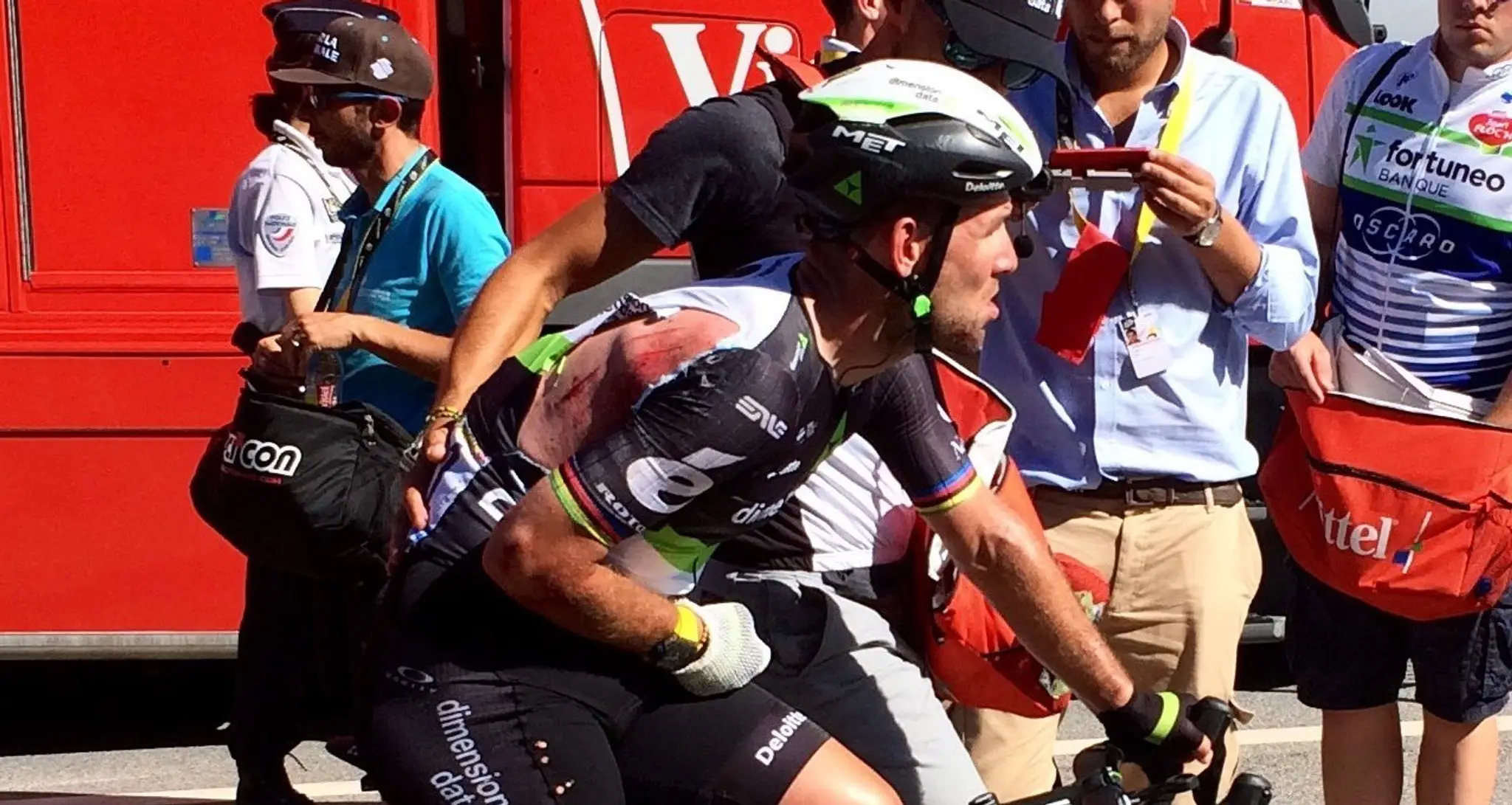 Doráňaný Mark Cavendish po 4. etape.