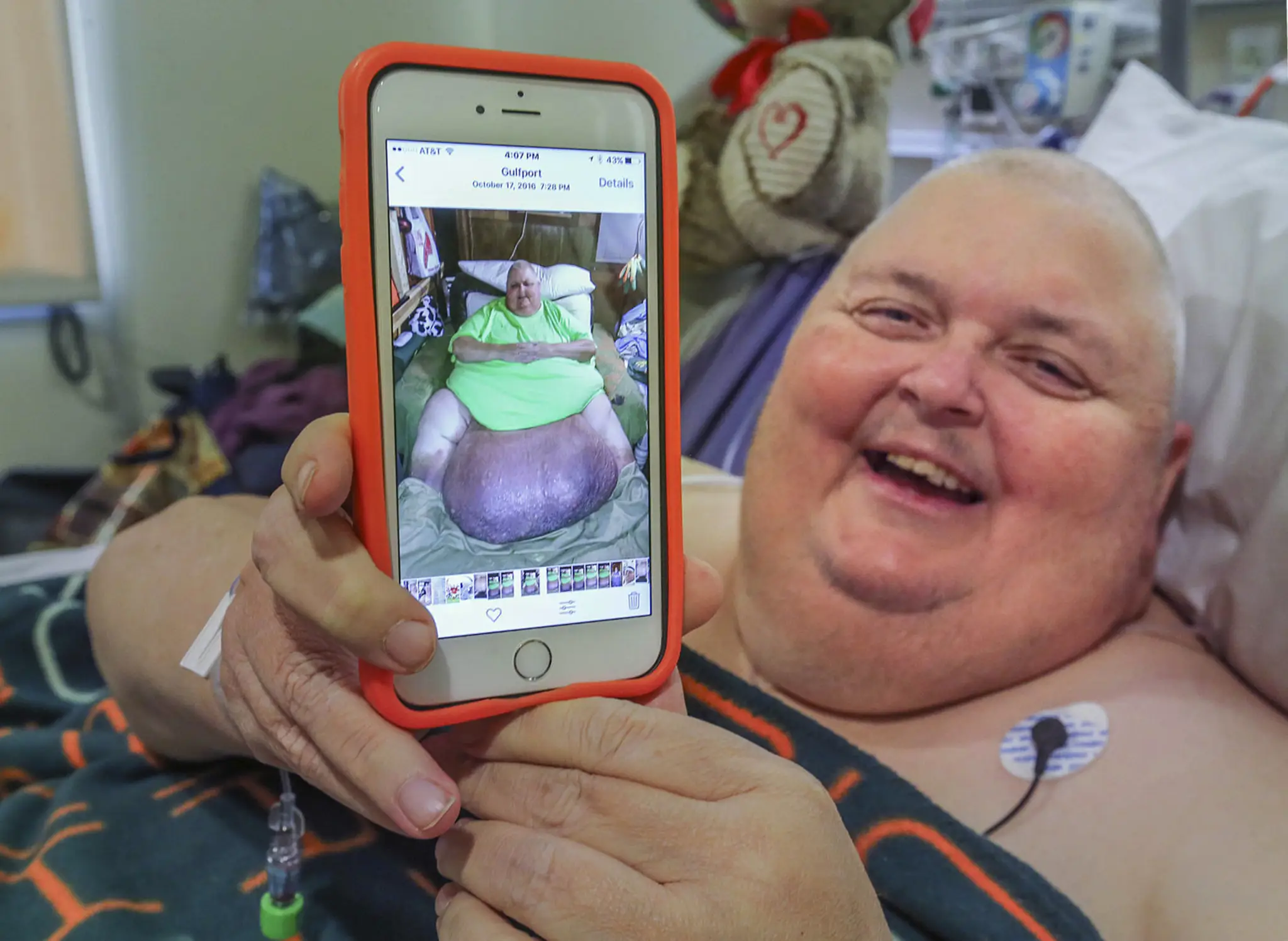 Tumor mu už nedovolil chodiť.