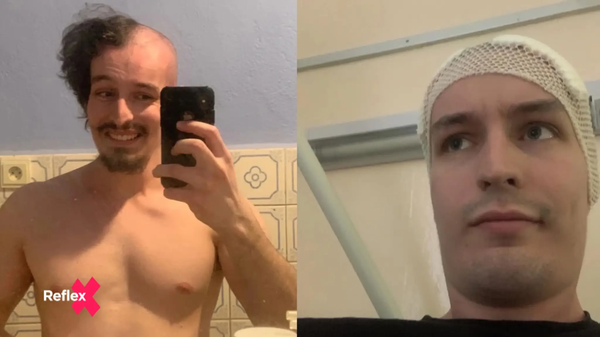 Krutá diagnóza ho nezlomila, rozhodol sa bojovať