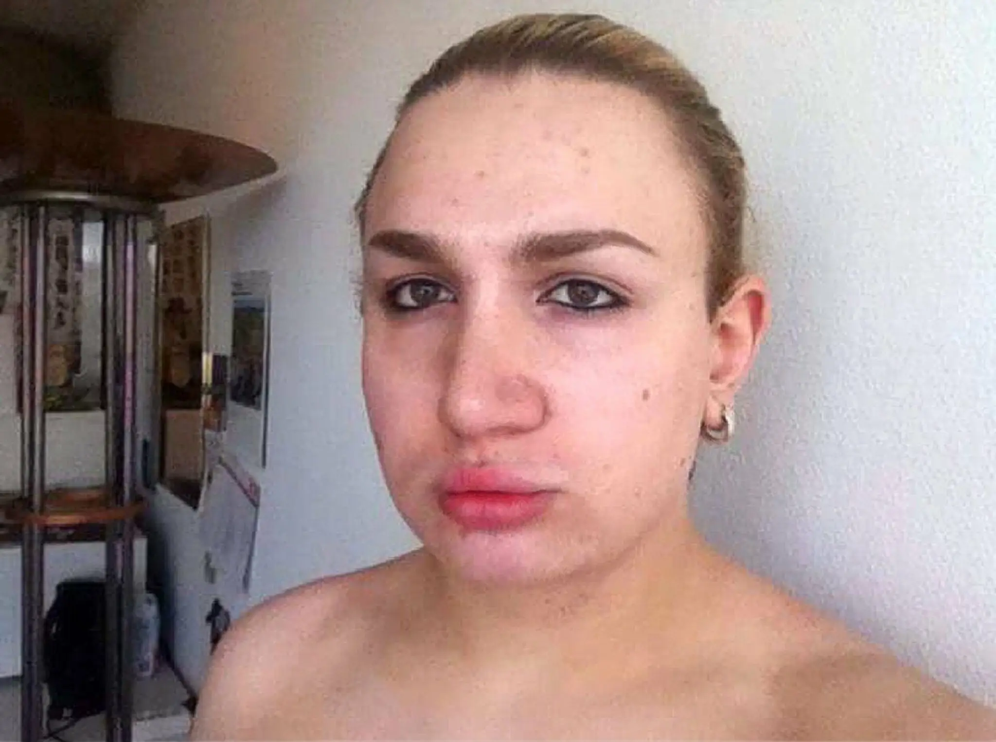 Ivana Vladislava pred odstránením silikónu.