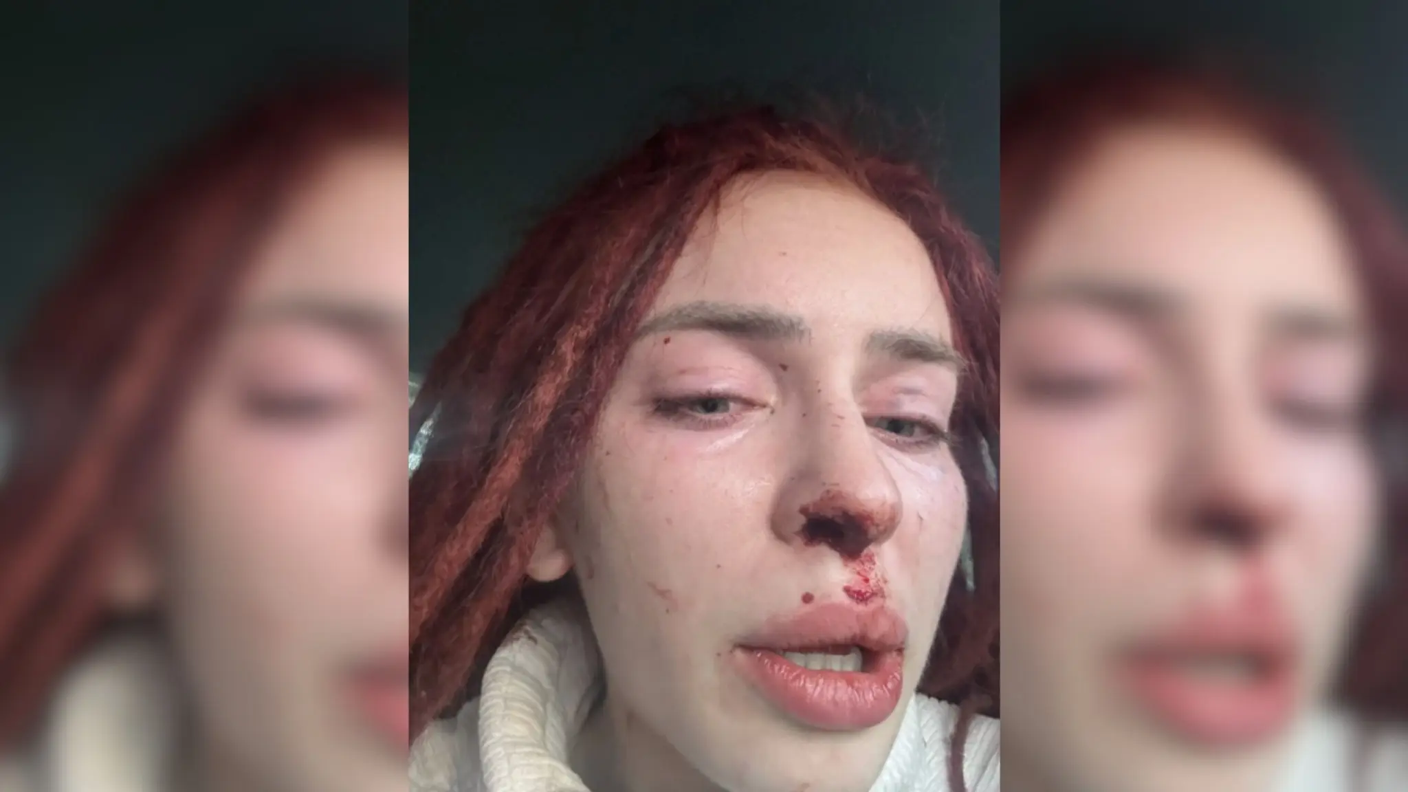 Influencerka Ráchel prehovorila o násilí.