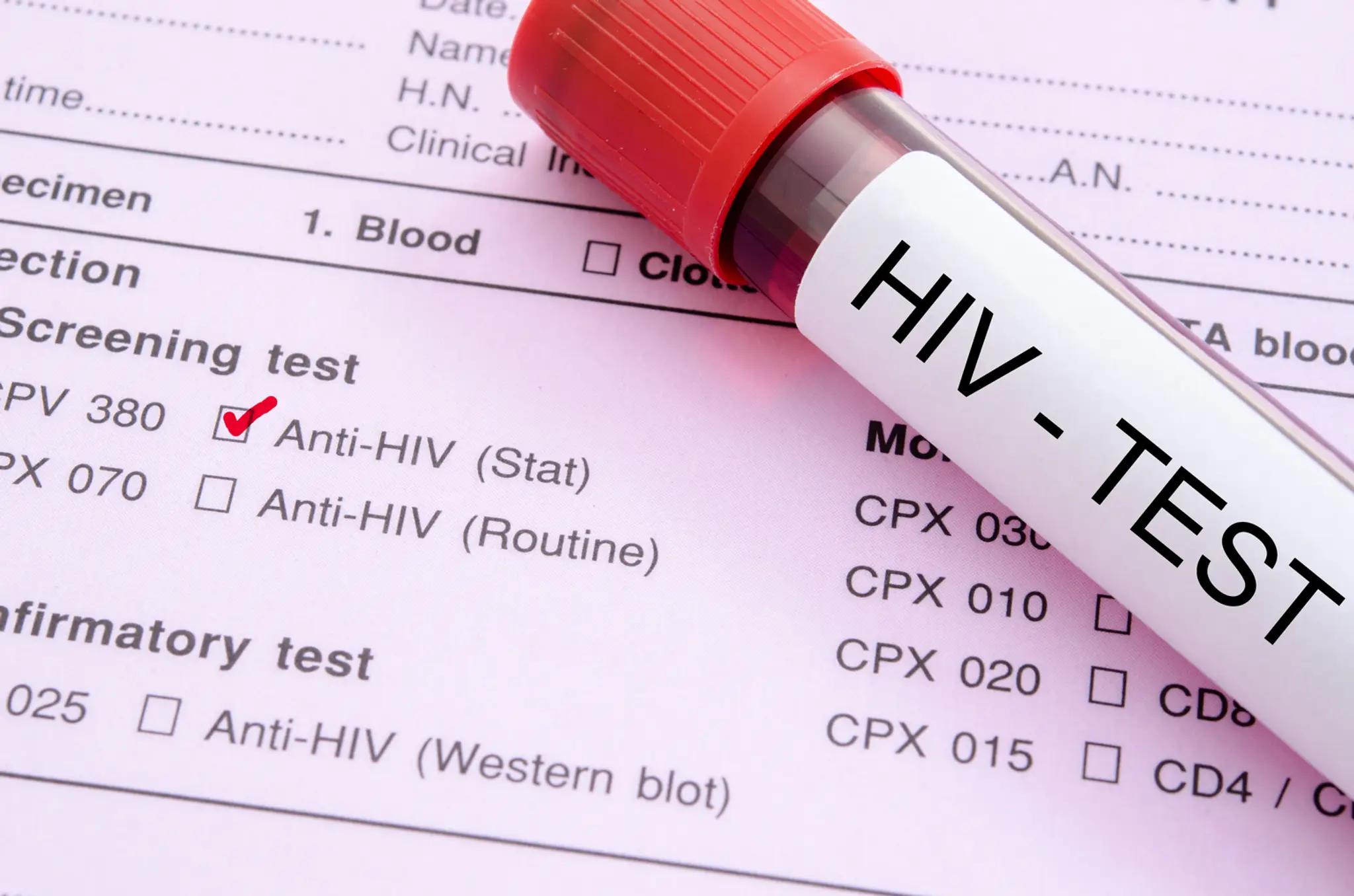 Vírus HIV- ilustračná snímka.