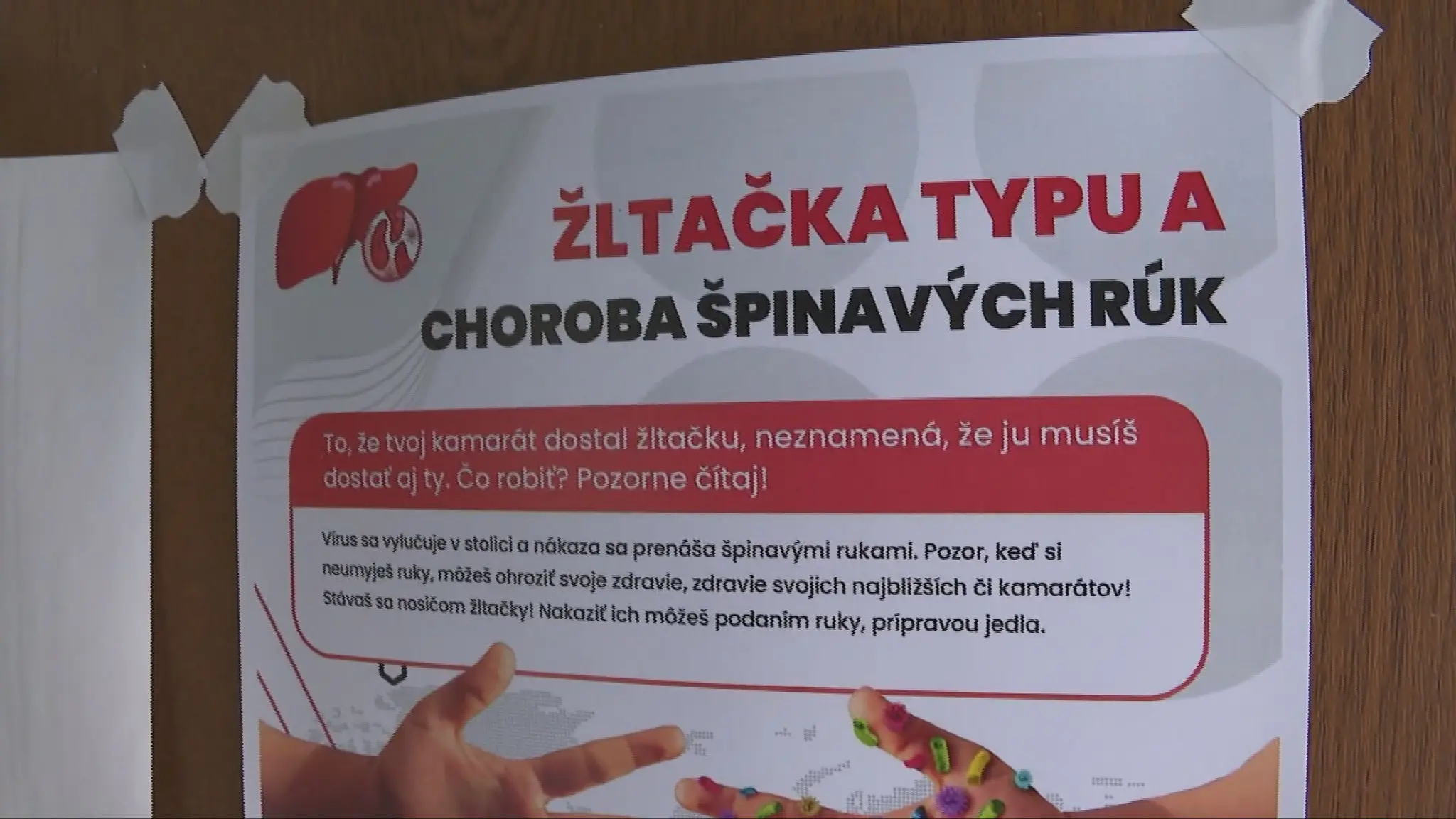 Žltačka typu A - ilustračná snímka