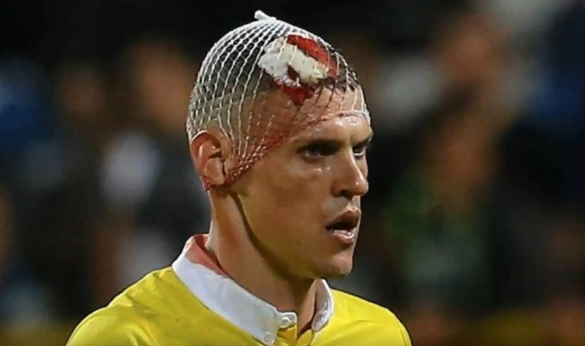 Martin Škrtel s obviazanou hlavou počas zápasu Fenerbahce - Kasimpasa.
