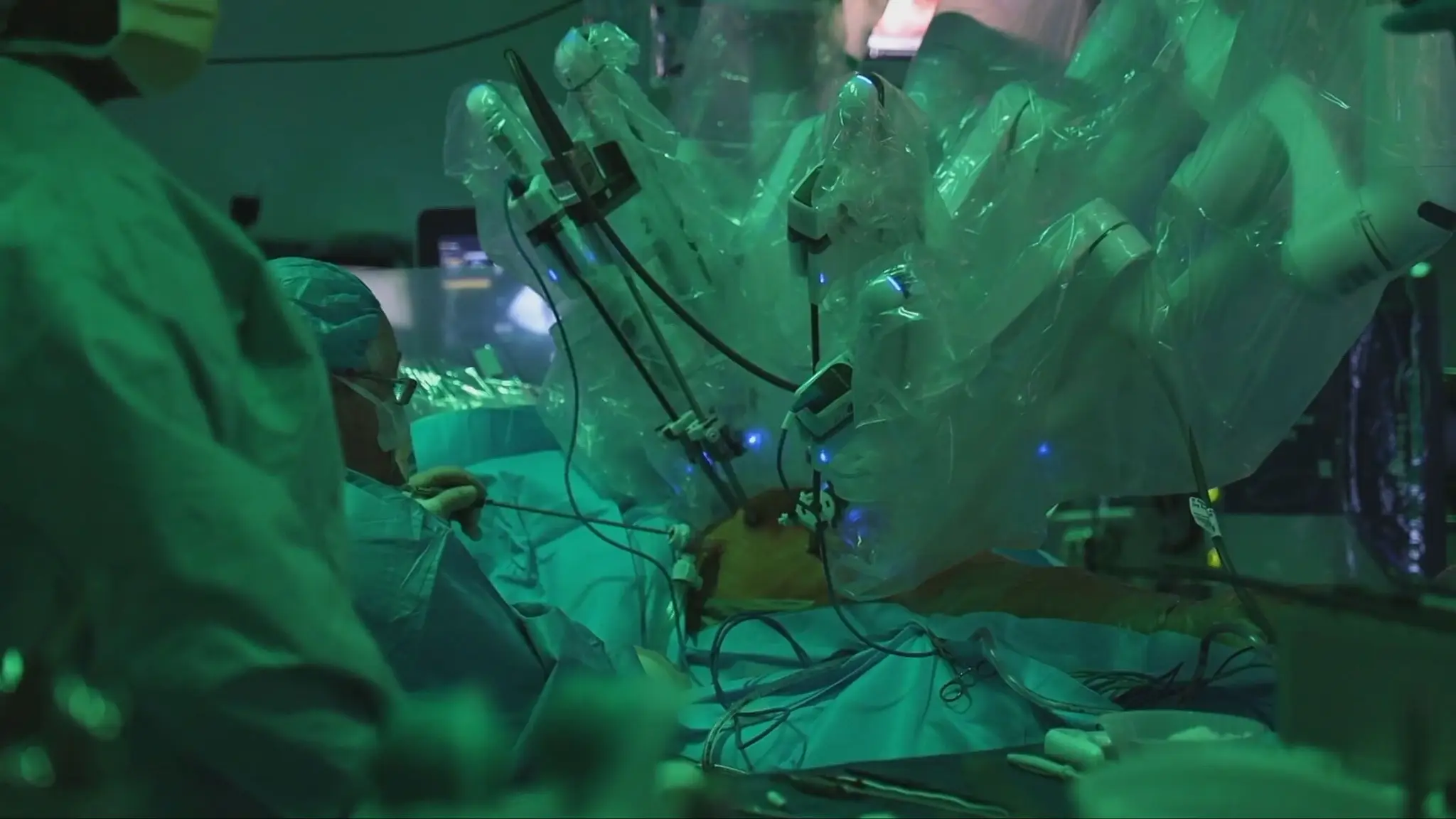 Pľúca transplantoval robot