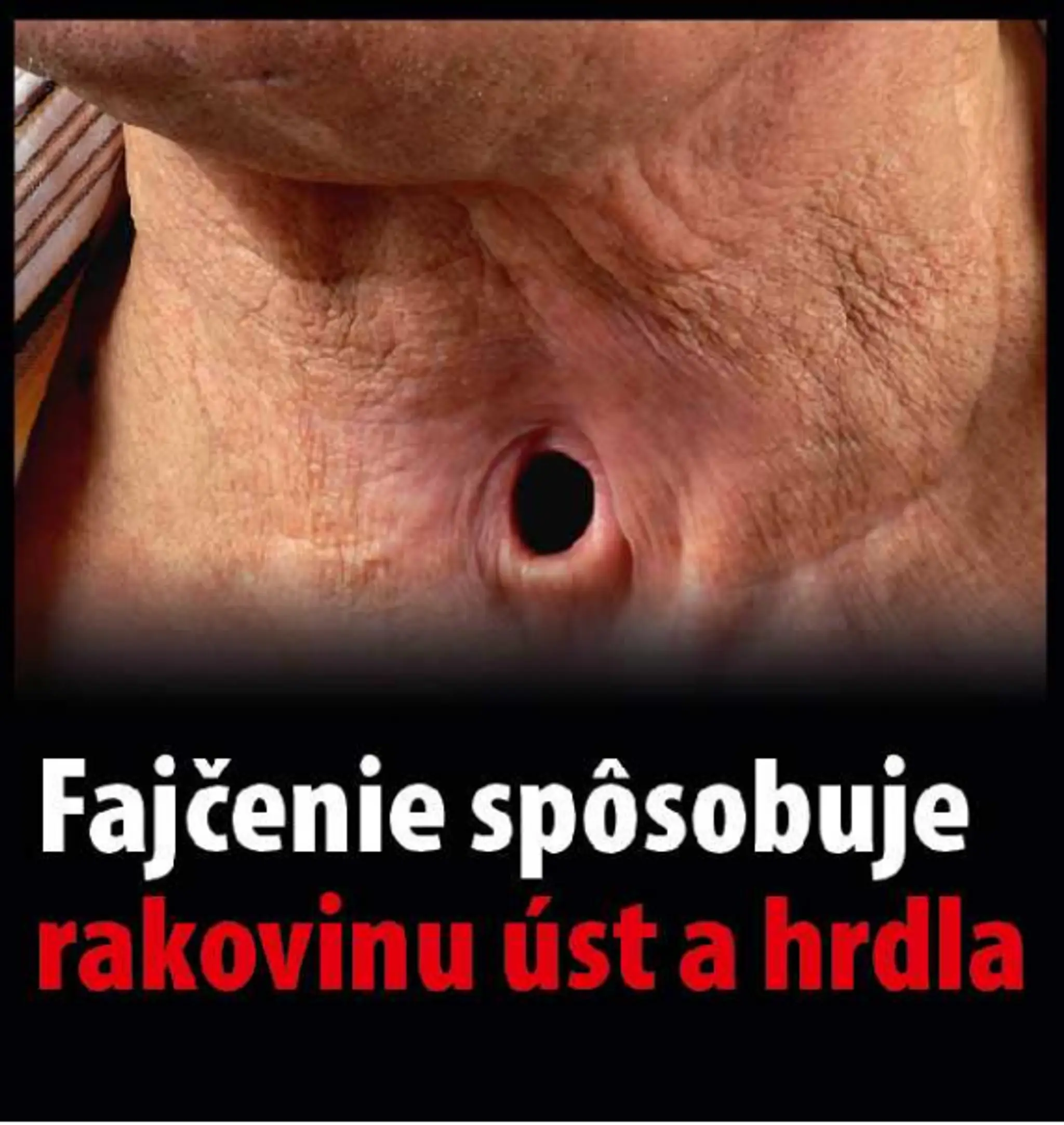 Varovanie, čo všetko môže spôsobiť fajčenie