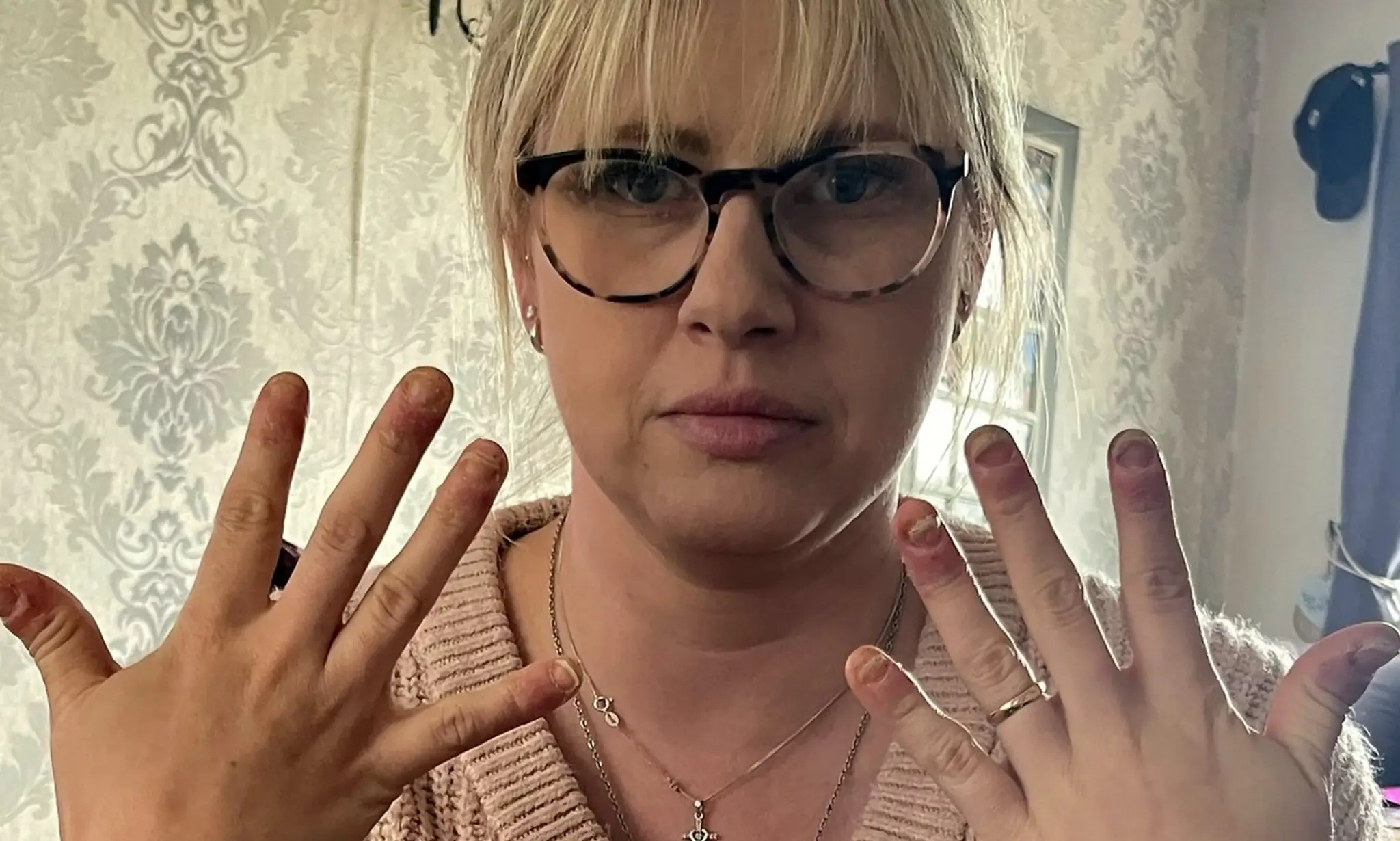 Lisa Deweyová oľutovala, že si dala urobiť gélové nechty.