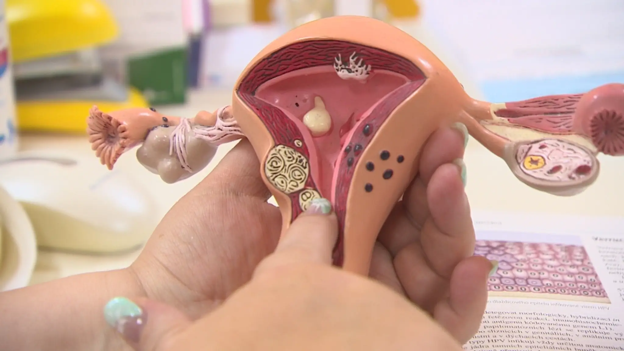 HPV vírus