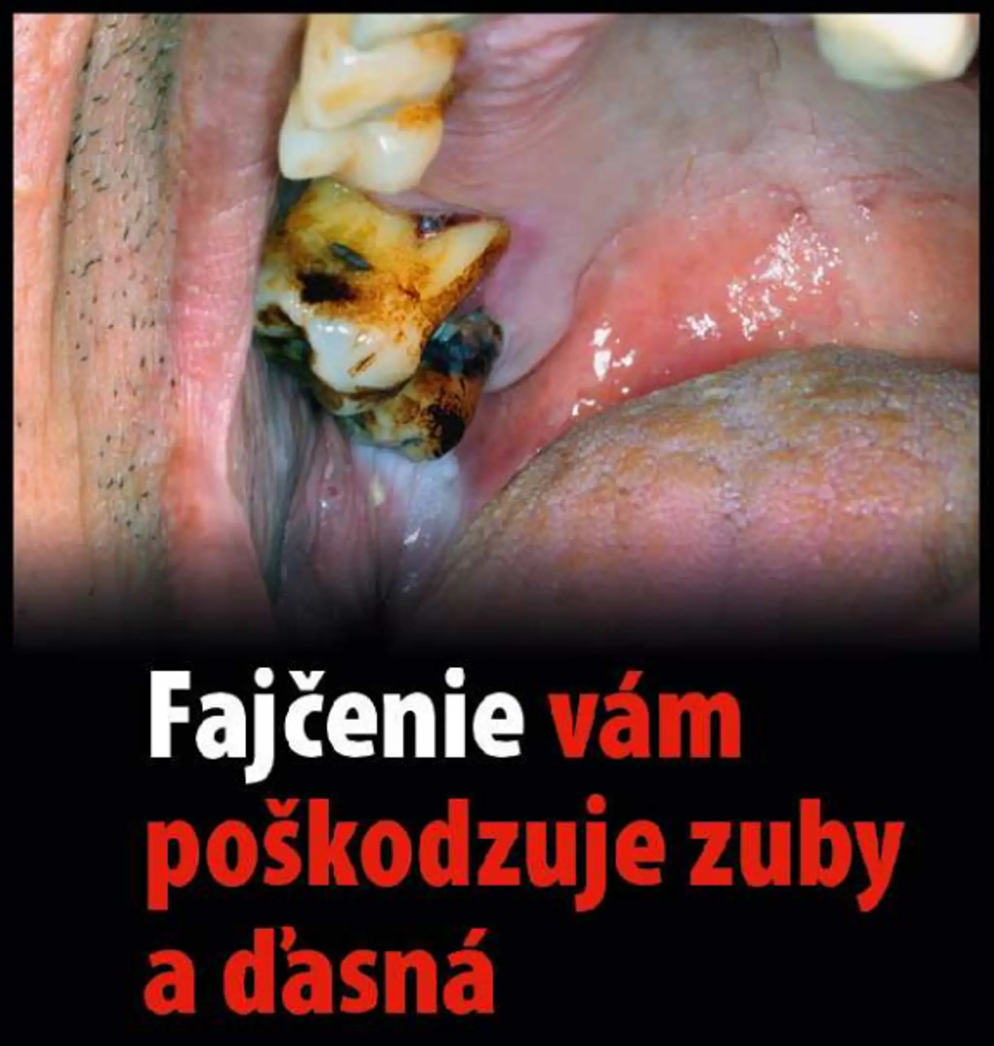 Varovanie, čo všetko môže spôsobiť fajčenie