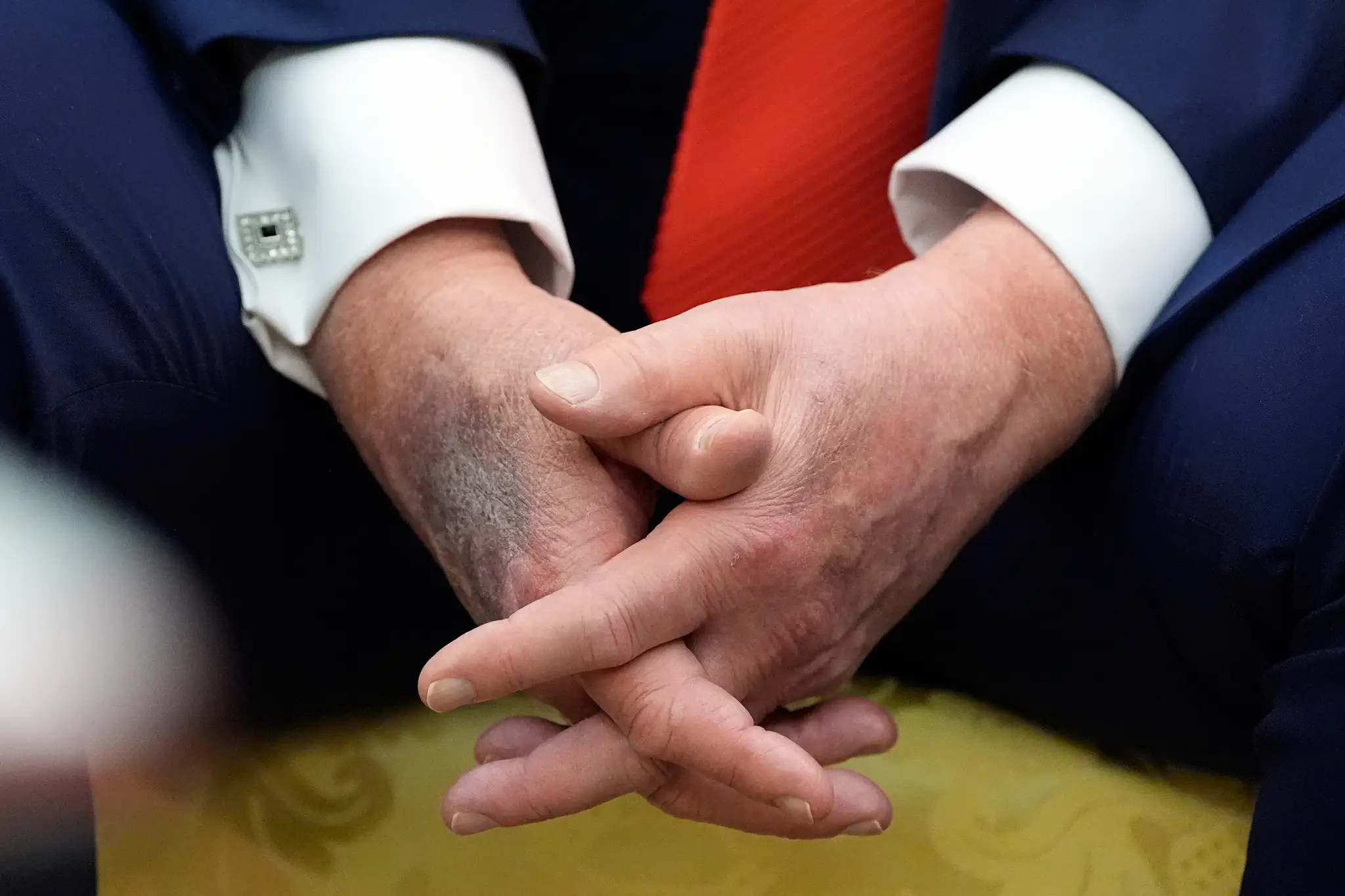 Trump modriny