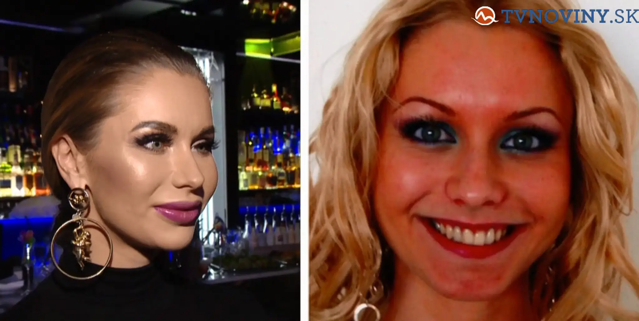 Modelka Eva Cifrová tvrdí, že má vylepšené prsia a tým to končí