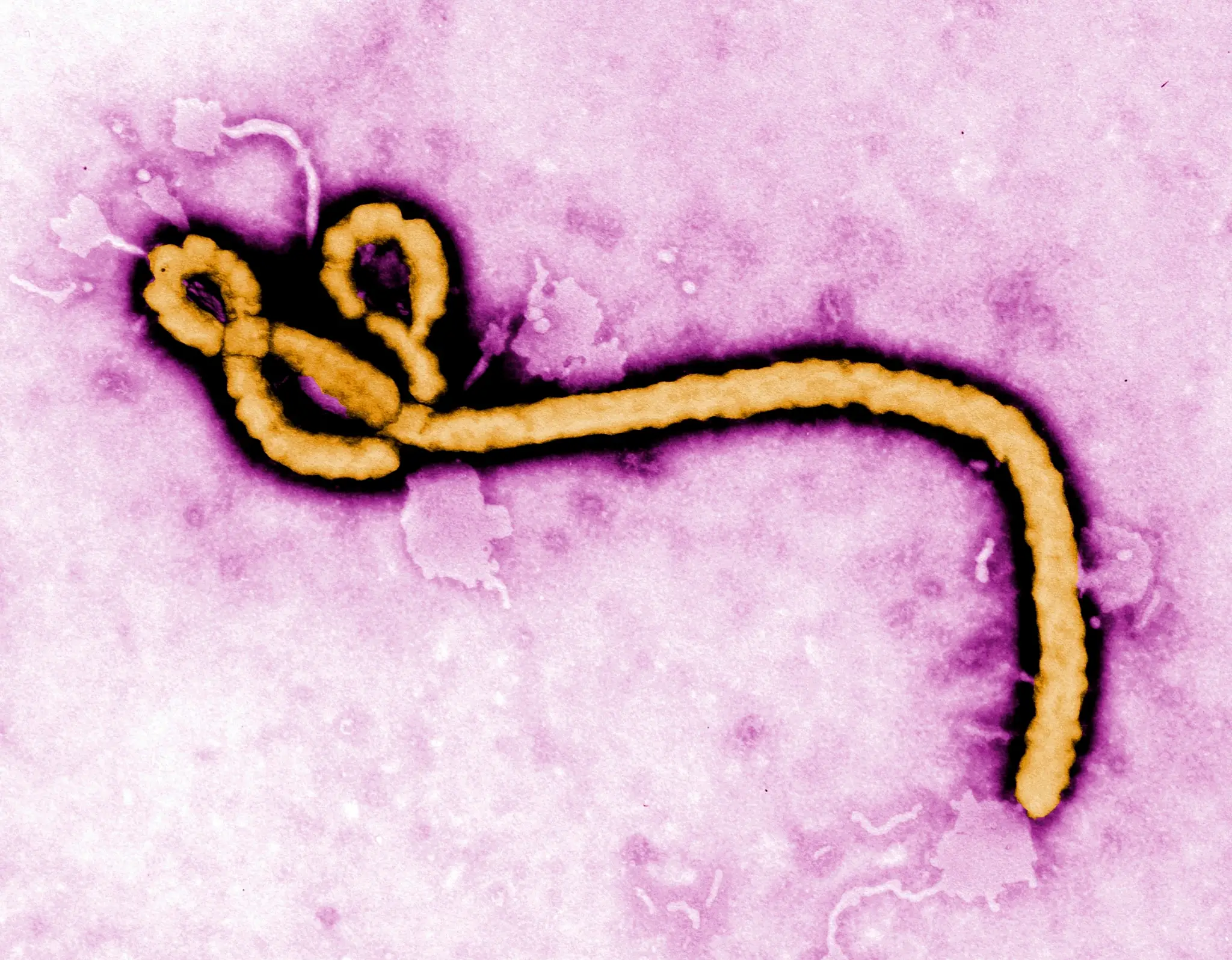 Ebola Kongo