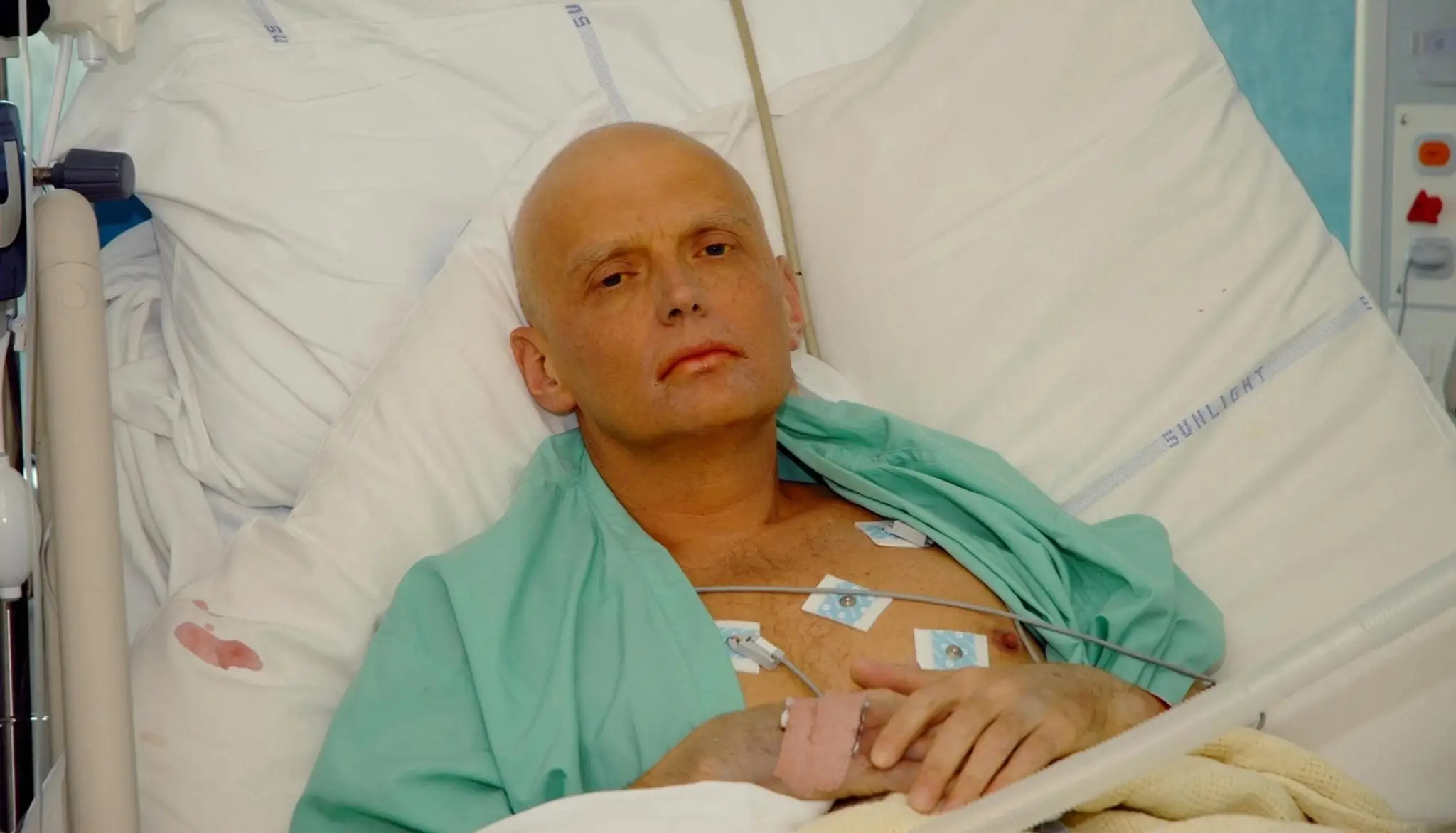 Bývalý ruský agent Alexander Litvinenko v londýnskej nemocnici na archívnej snímke z roku 2006.