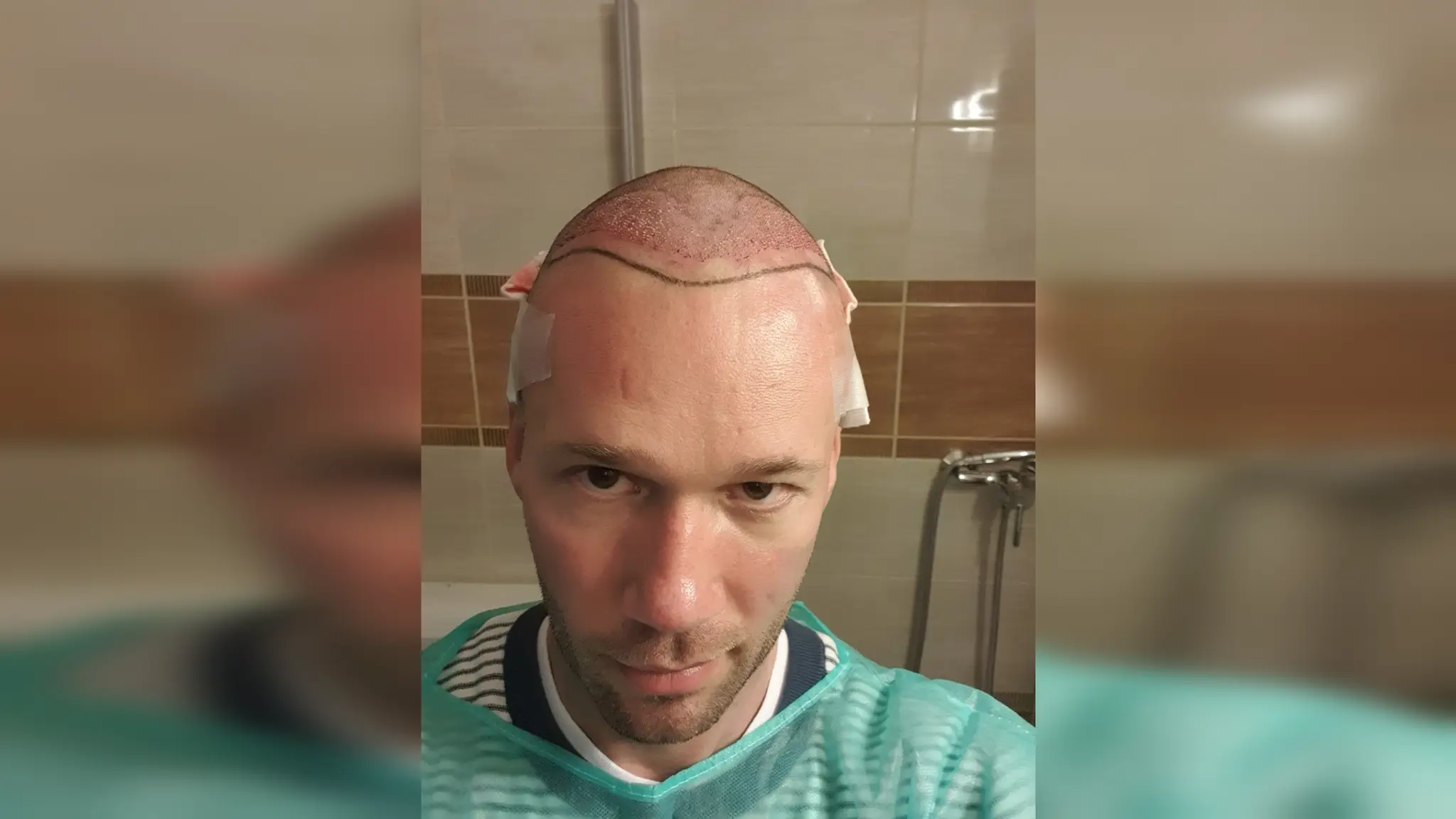 Takto to vyzeralo počas zákroku.