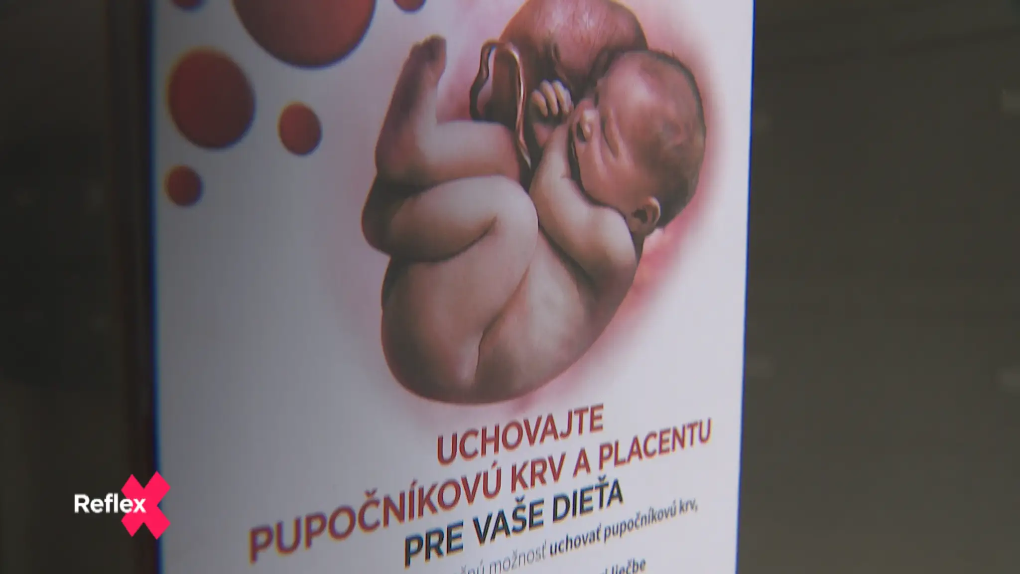 Využívanie pupočníkovej krvi