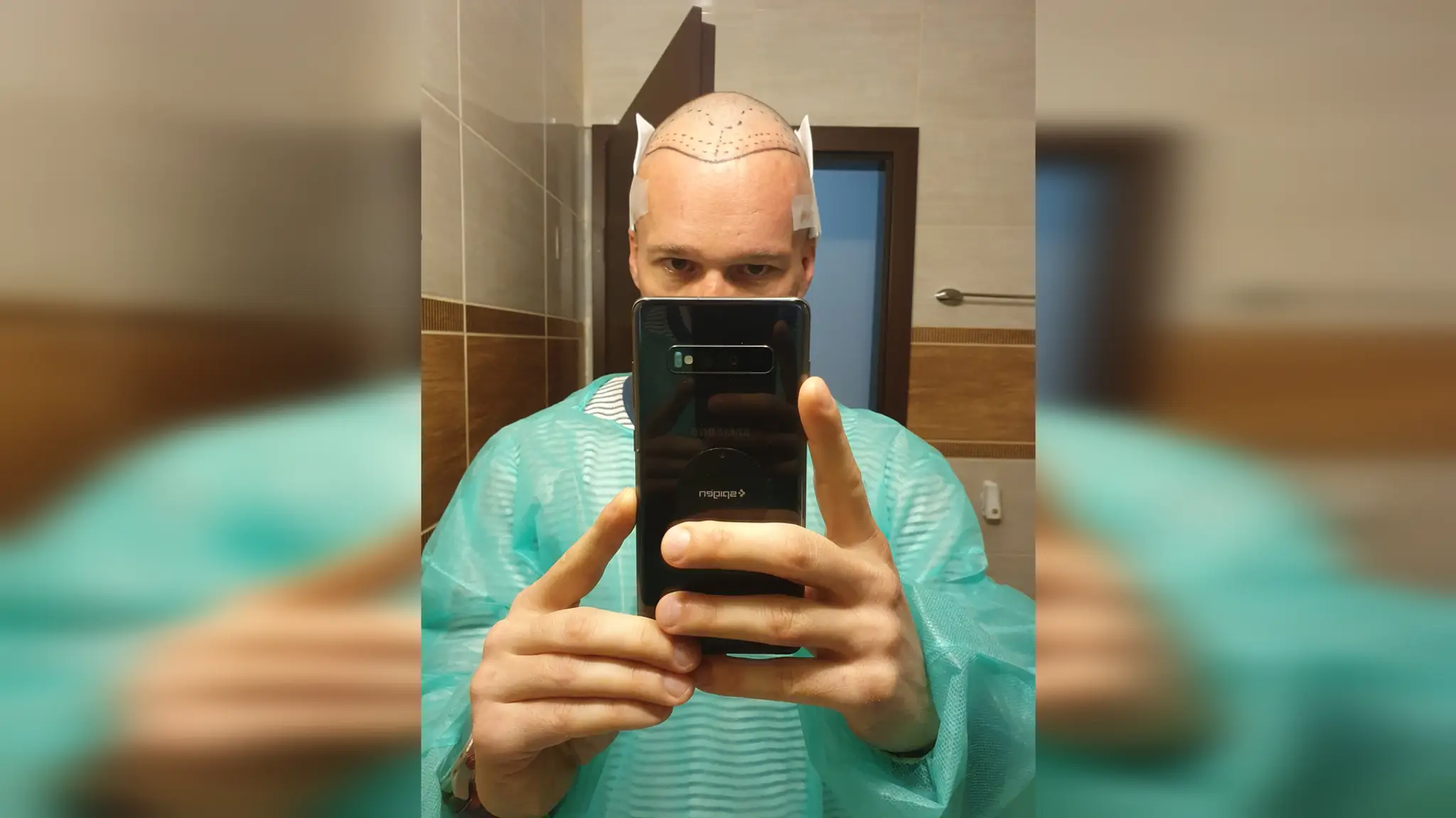 Roman počas zákroku.