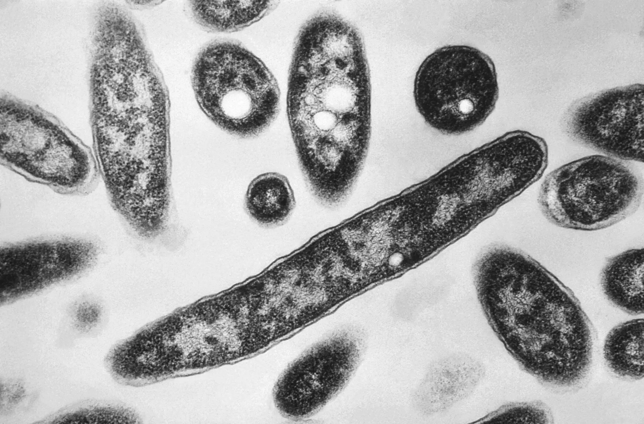Legionella pod elektrónovým mikroskopom.