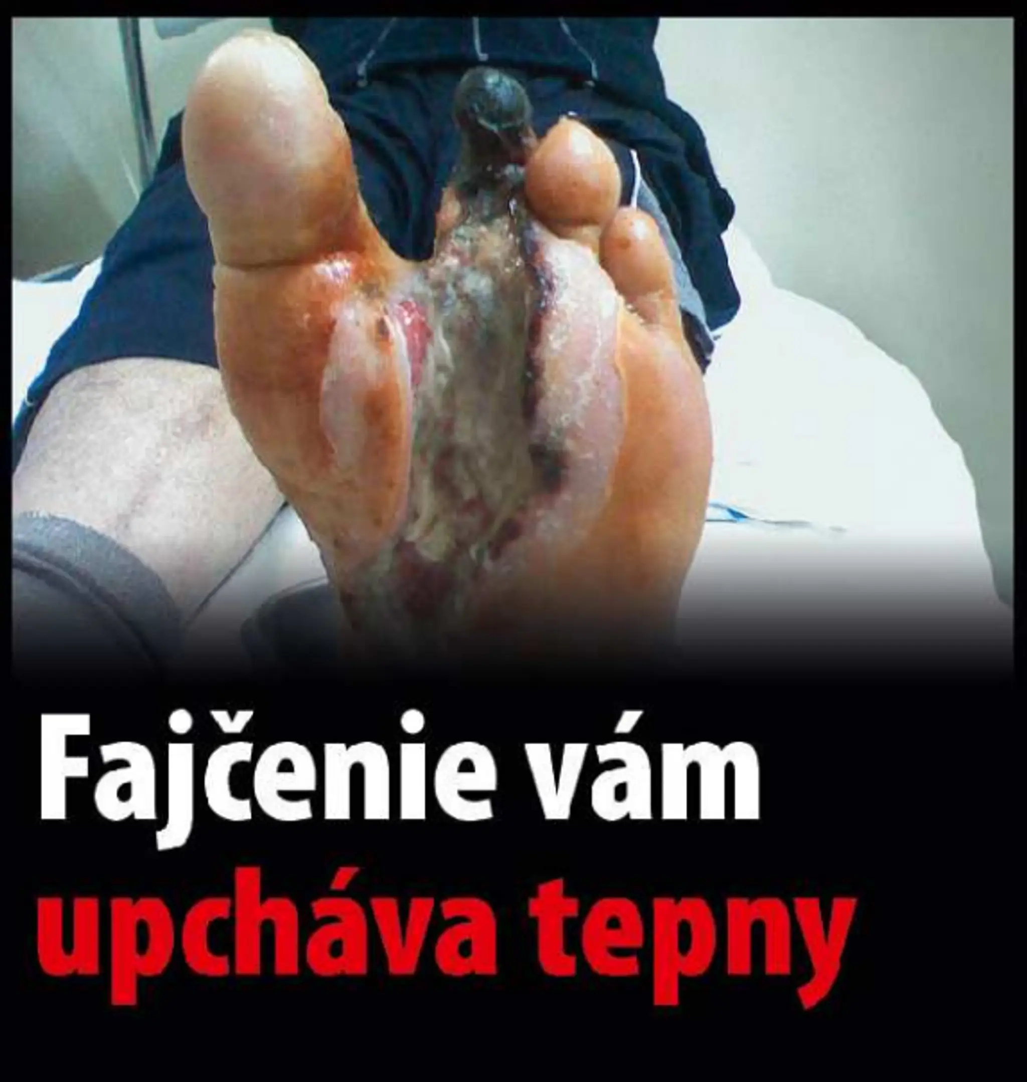 Varovanie, čo všetko môže spôsobiť fajčenie