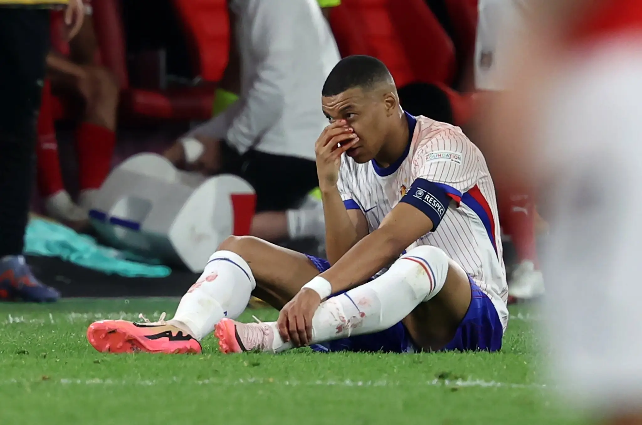 Mbappé po náraze do hlavy