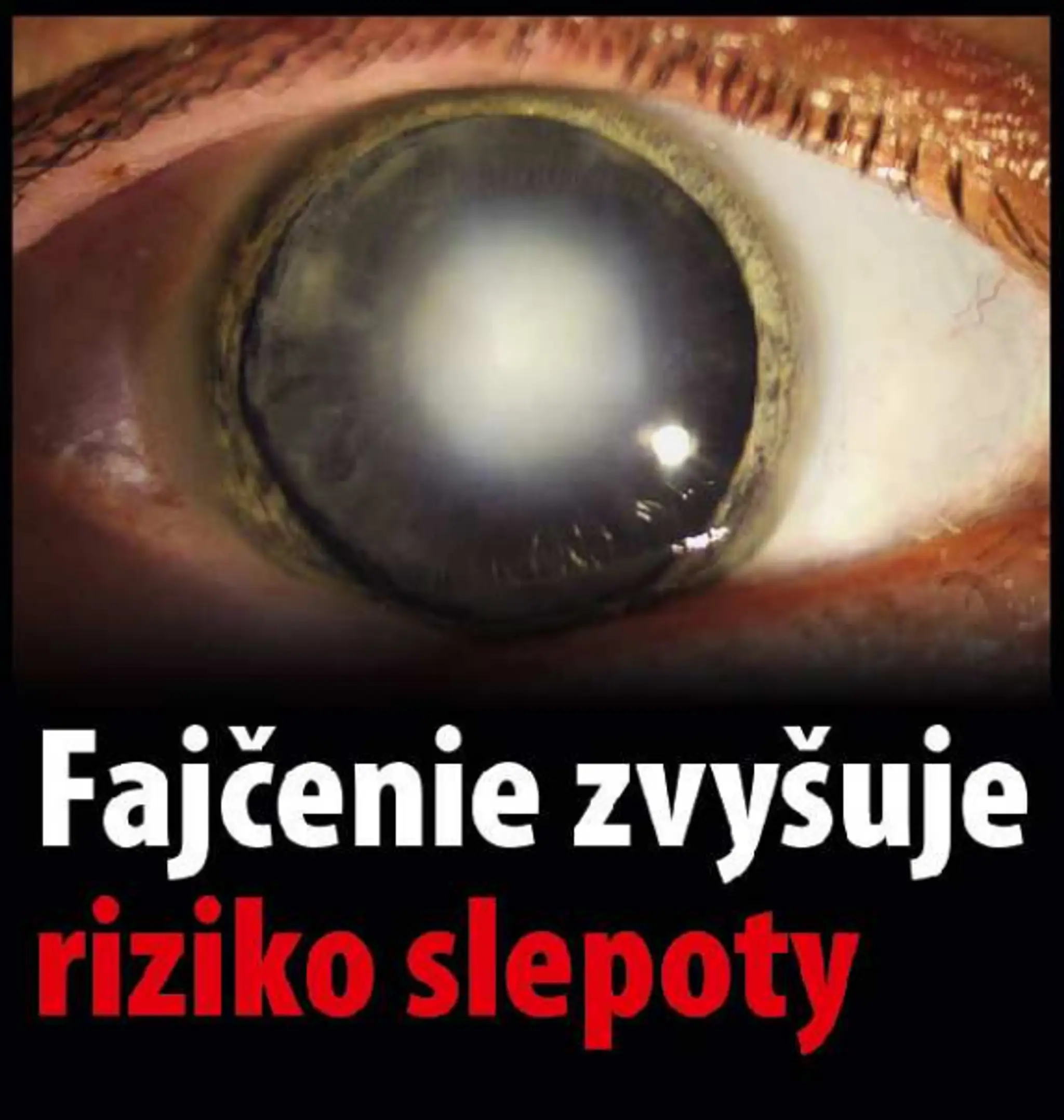 Varovanie, čo všetko môže spôsobiť fajčenie
