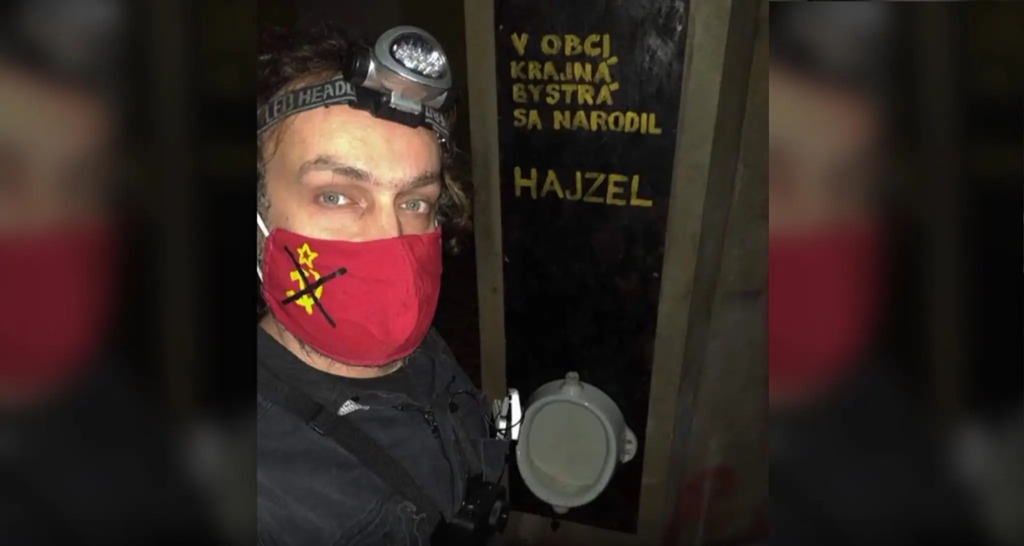 Sofinke aplikovali liek zolgensma už pred dvomi rokmi.