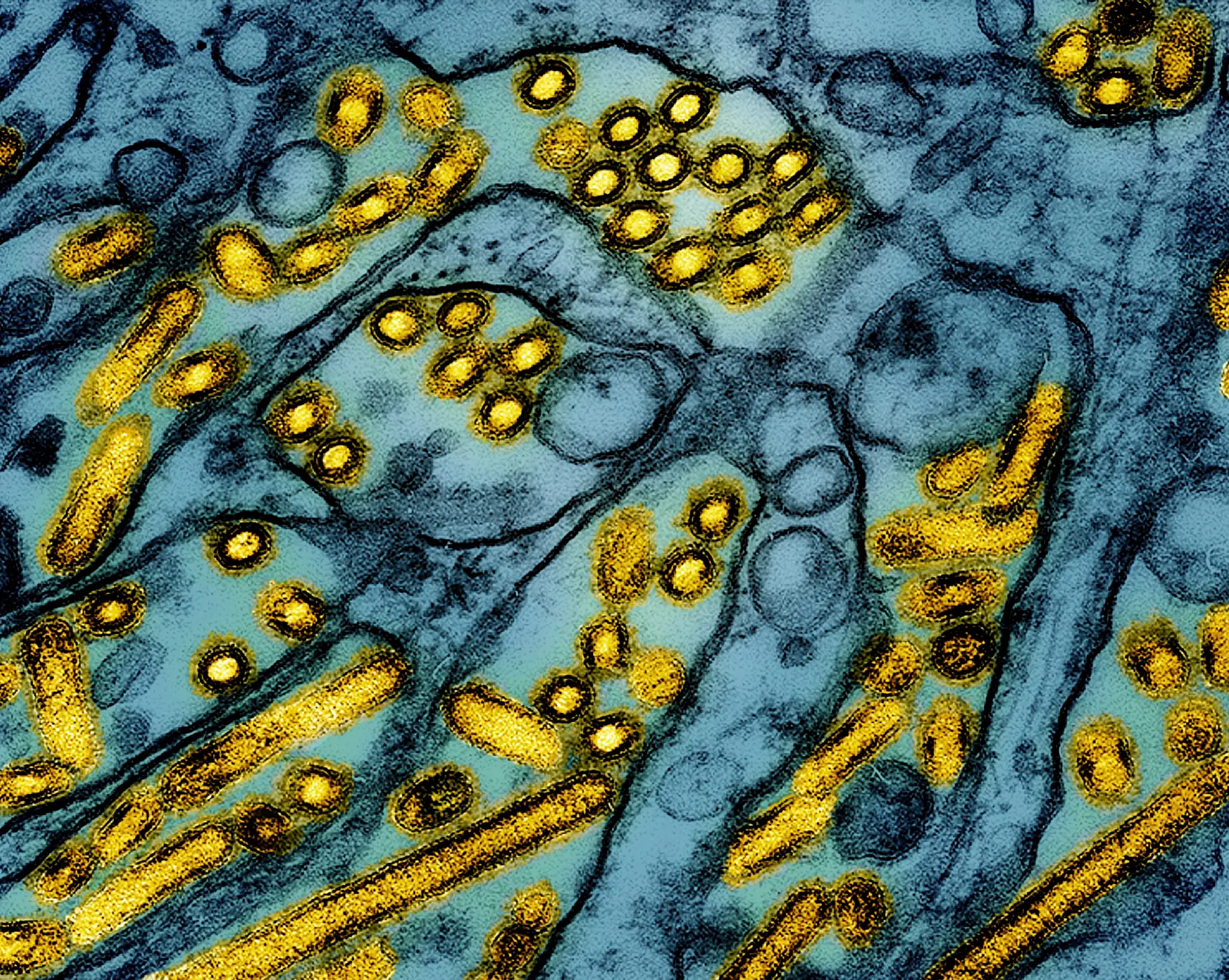 Na snímke častice vírusu (žlté) vtáčej chrípky A H5N1.