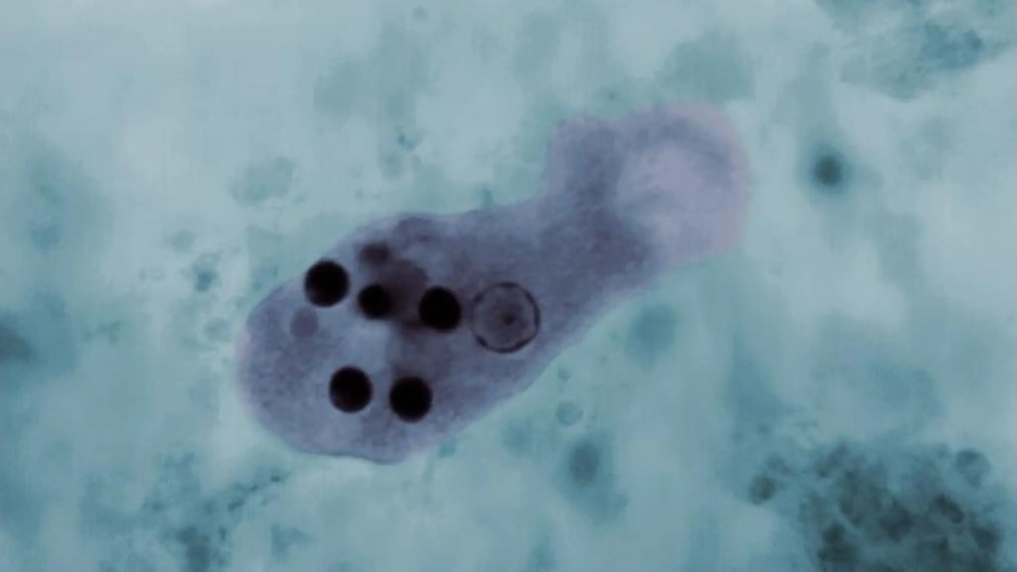 Améba Entamoeba histolytica