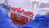 Vedcom sa podarilo objaviť významnú mutáciu koronavírusu, ktorá ho výrazne oslabuje
