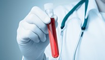Vedci vyvinuli krvný test s veľkou presnosťou. Už v zárodku odhalí 50 druhov rakoviny