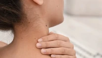 Ako spoznať nebezpečné znamienko? Pomôže jednoduché pravidlo ABCDE