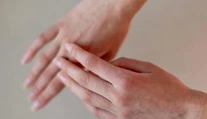 Zima poškodzuje pokožku viac, než si myslíte. Dermatologička radí, čo pomáha